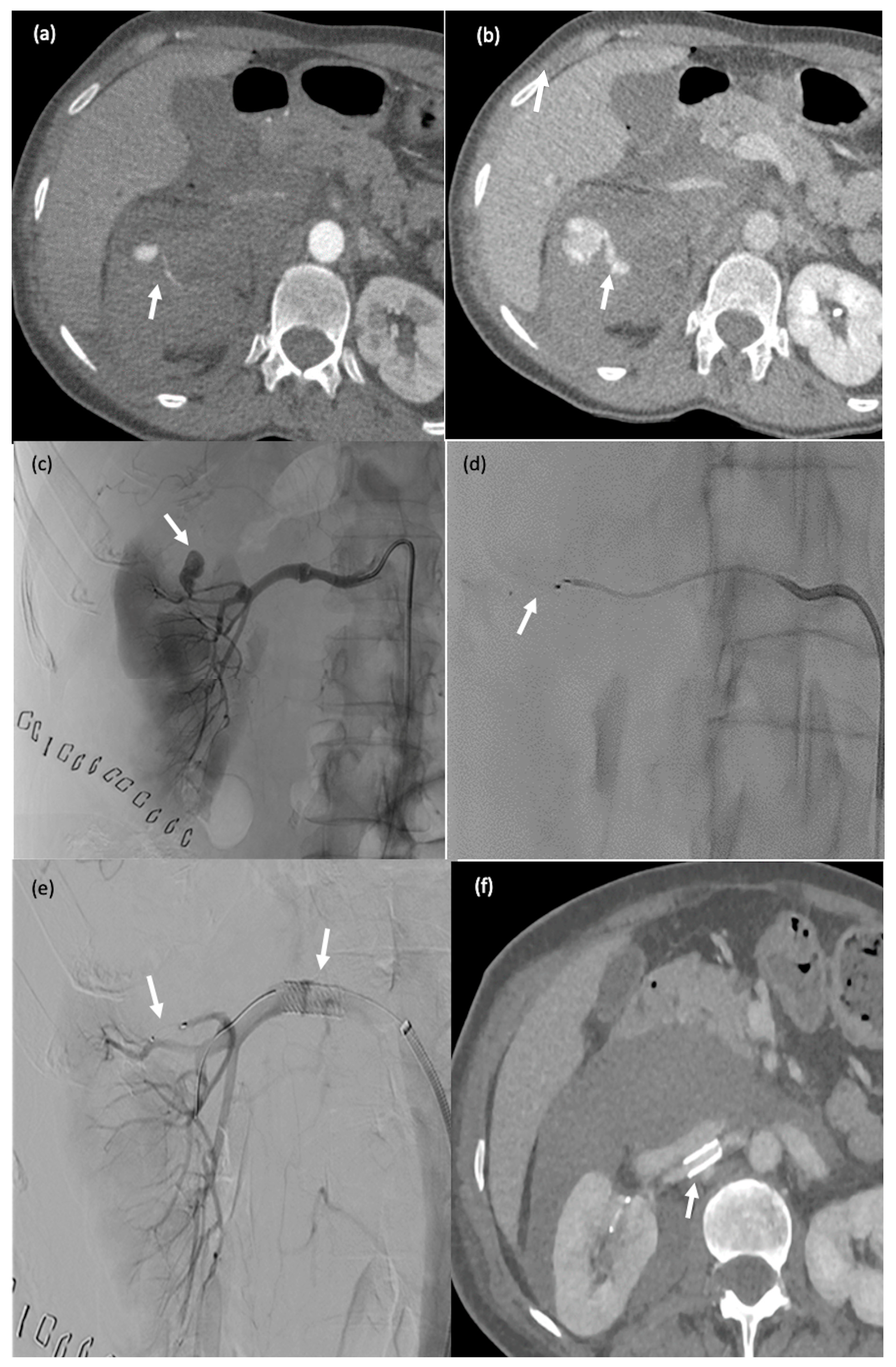 Biomedicines 11 02172 g005