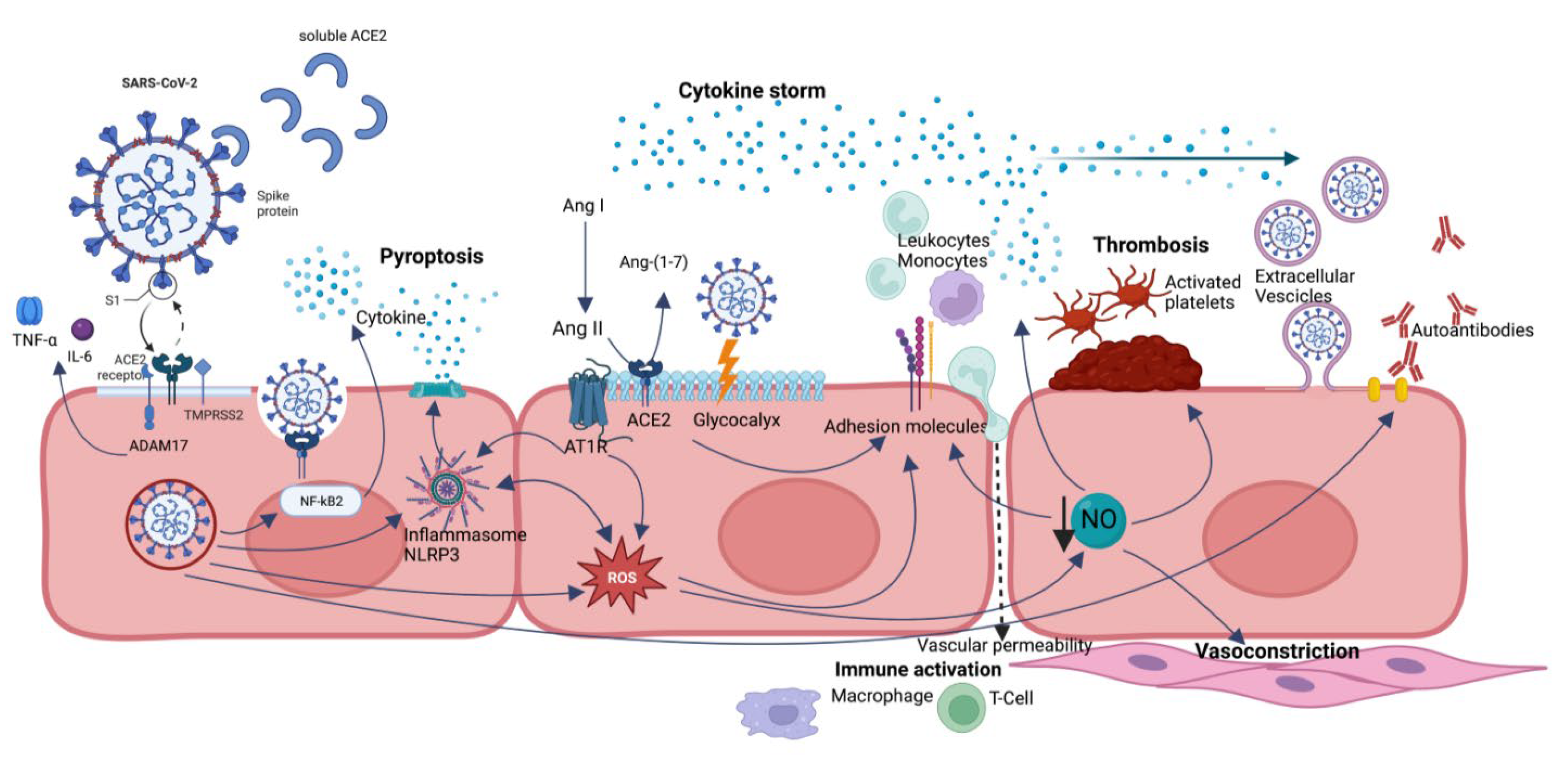 Endothelial cell infection and endotheliitis in COVID-19 - The Lancet