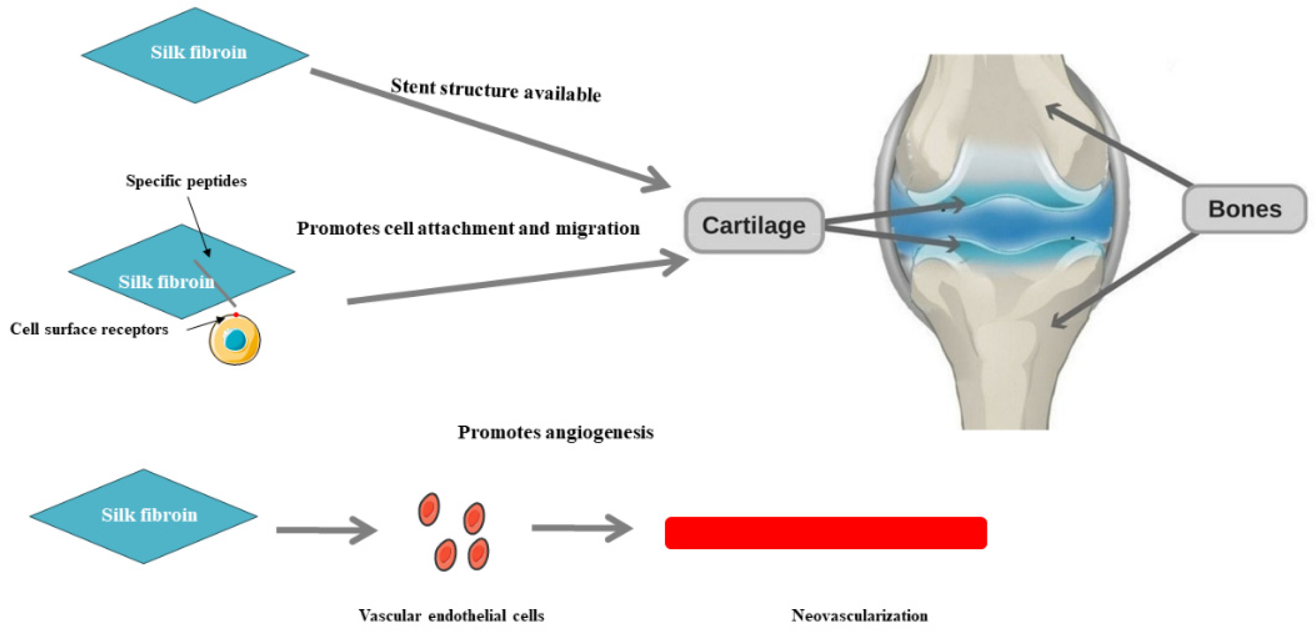 Silk fibroin scaffolds for common cartilage injuries