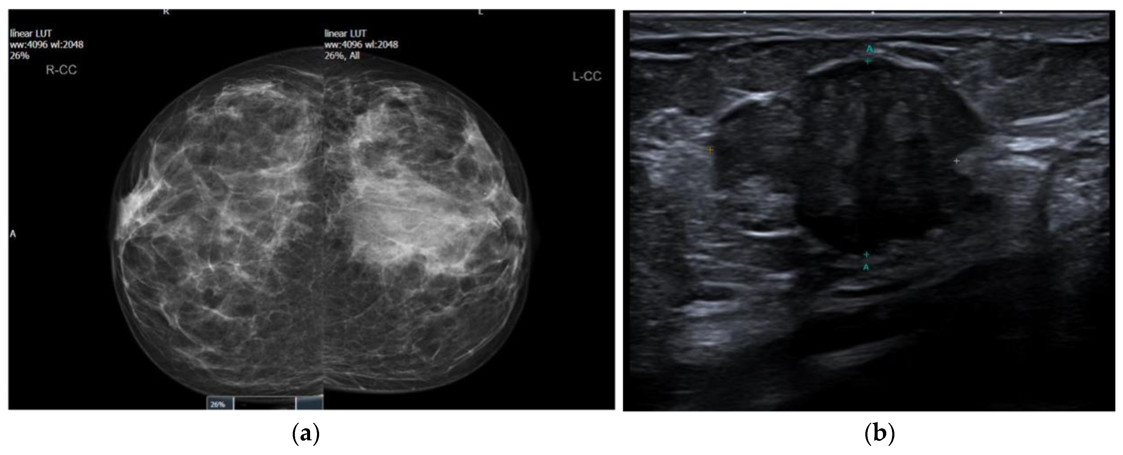 Biomedicines 11 02376 g001