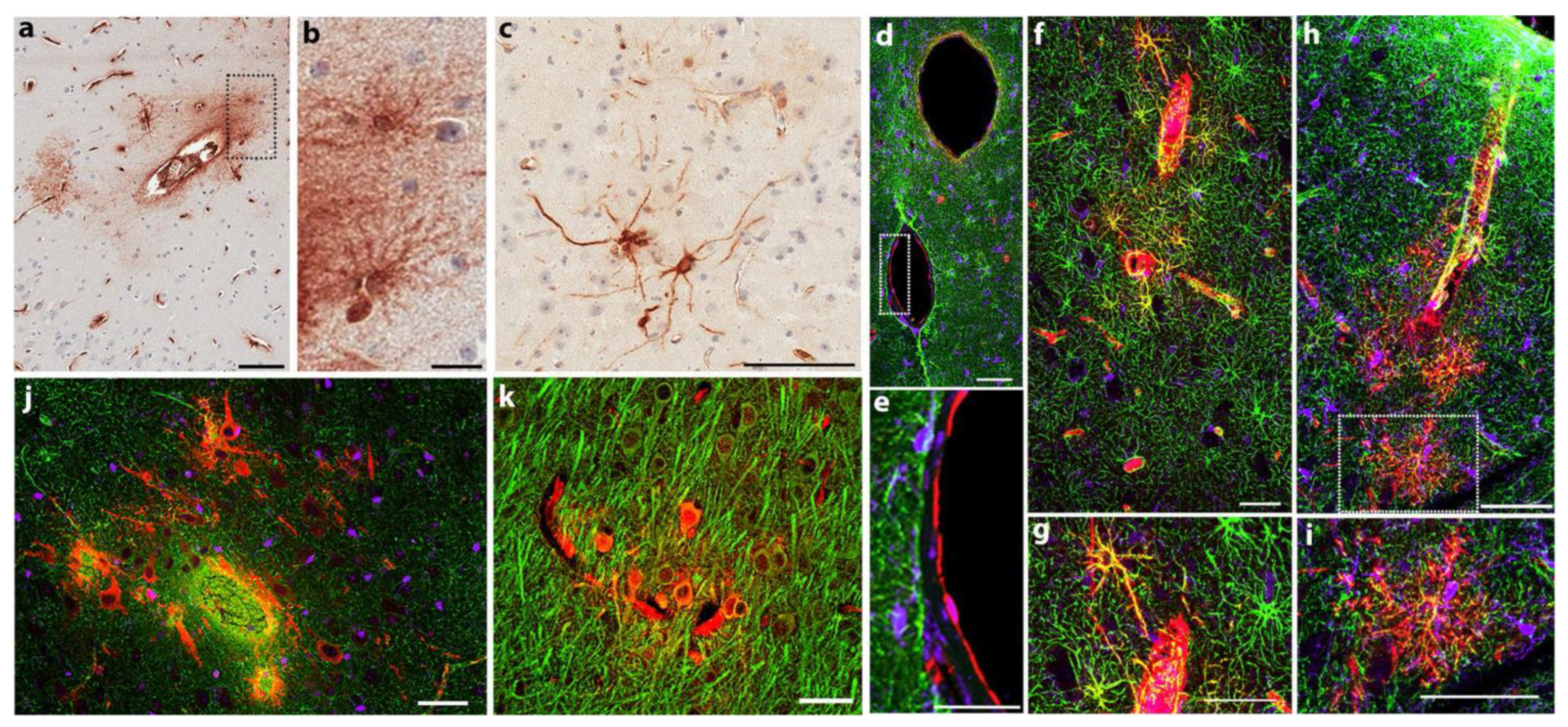 Biomedicines 11 02388 g003 Biomedicines 11 02388 g003