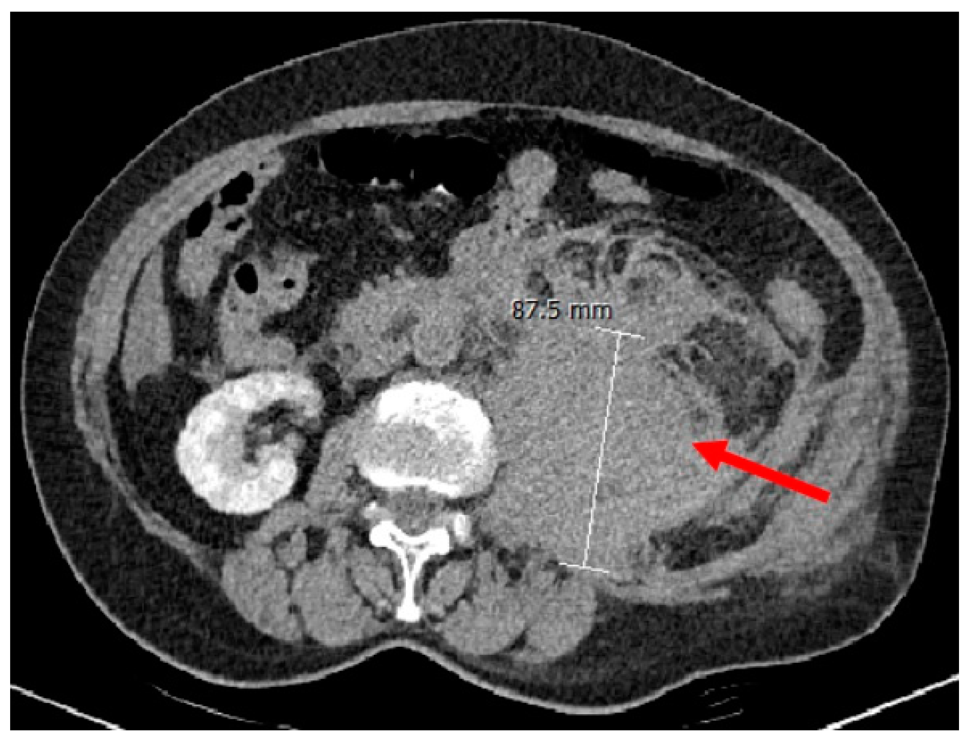 Biomedicines 11 02400 g001
