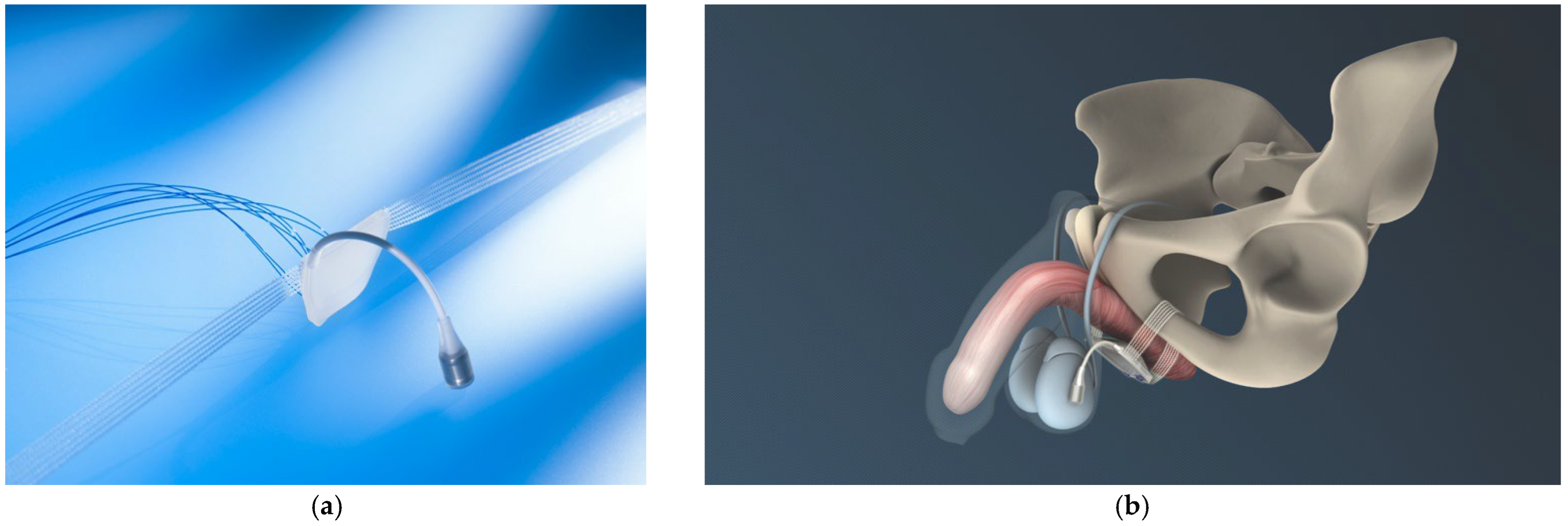 Biomedicines 11 02486 g009 Biomedicines 11 02486 g009