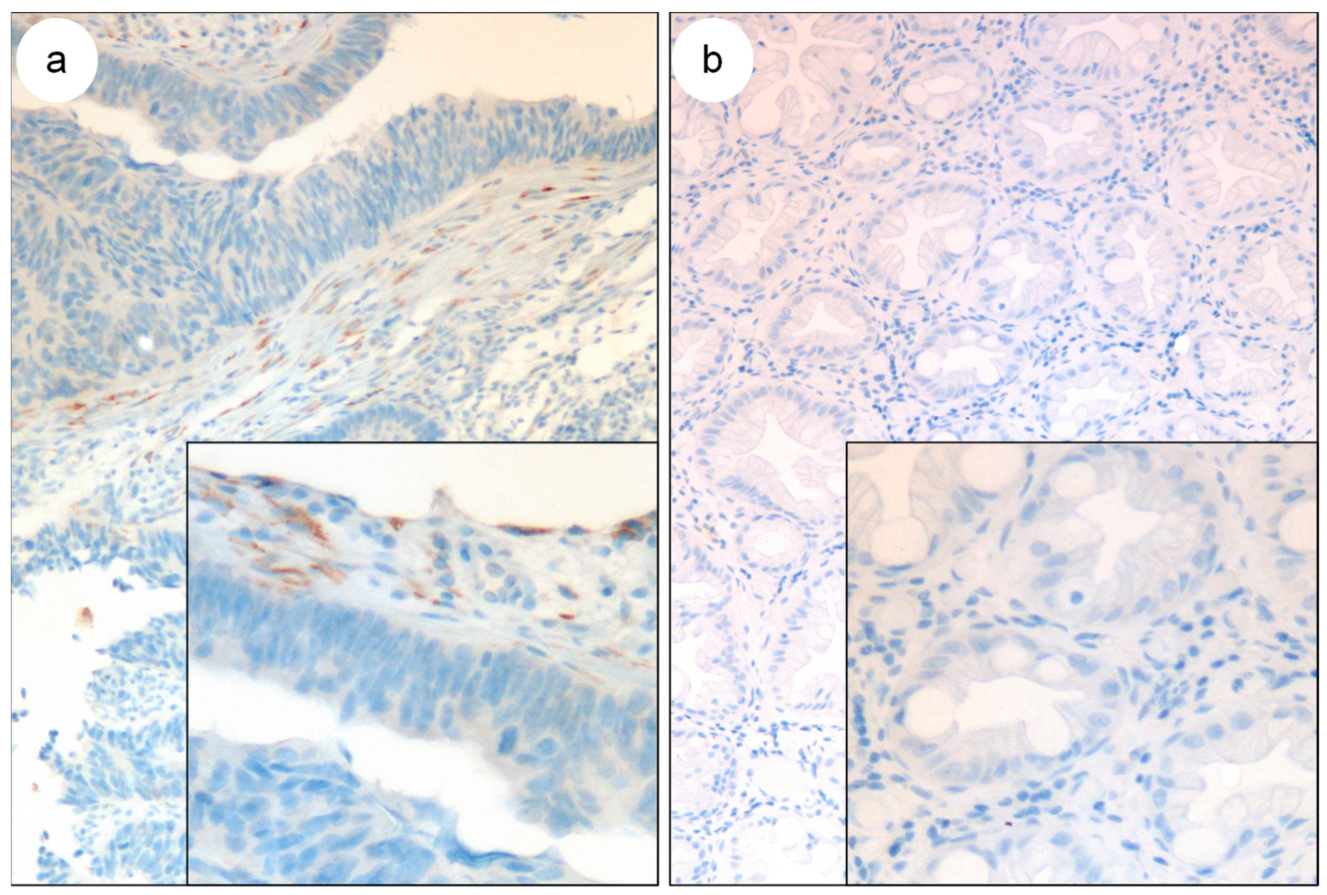 Biomedicines 11 02496 g002 Biomedicines 11 02496 g002