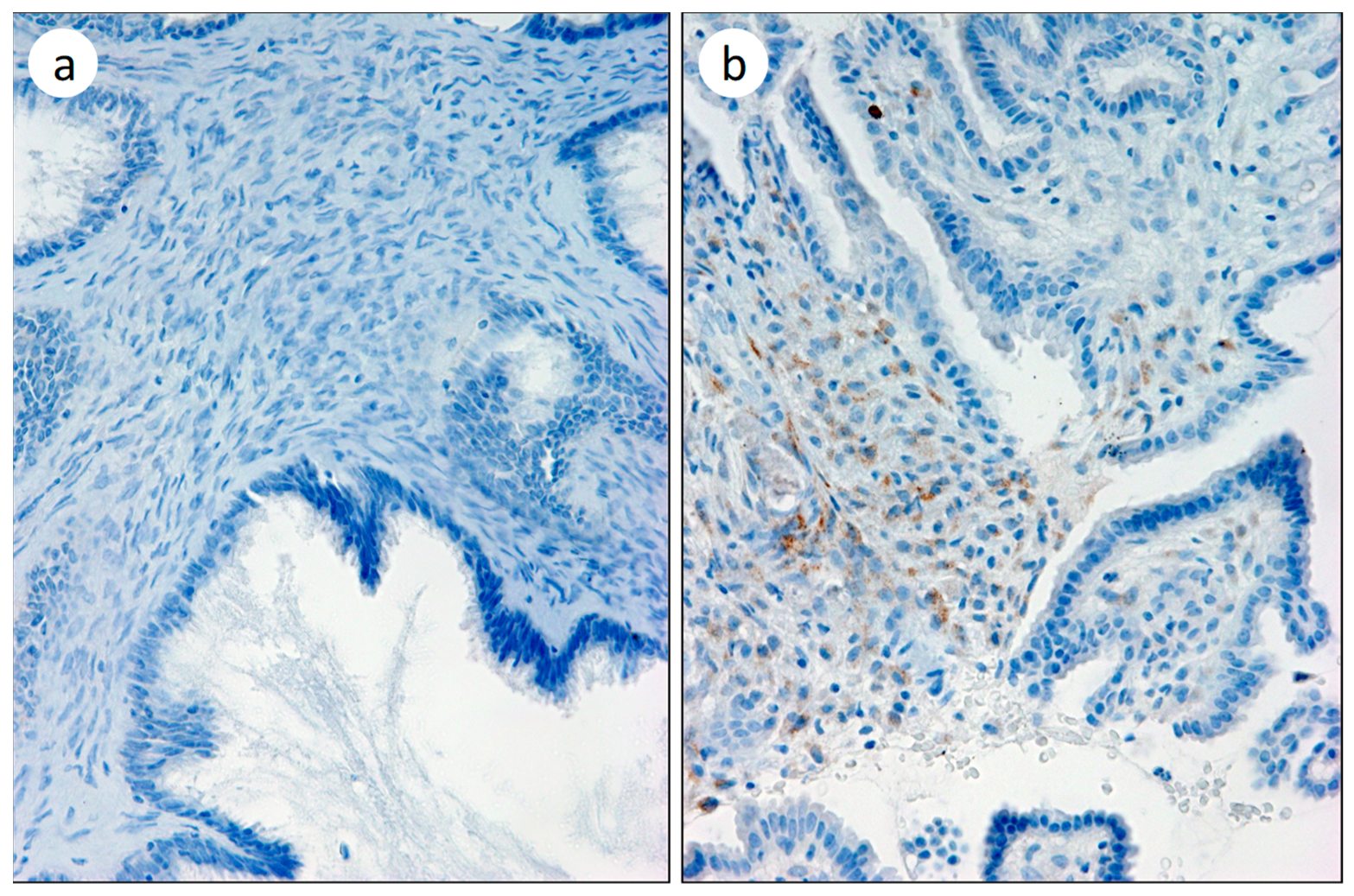 Biomedicines 11 02496 g005 Biomedicines 11 02496 g005