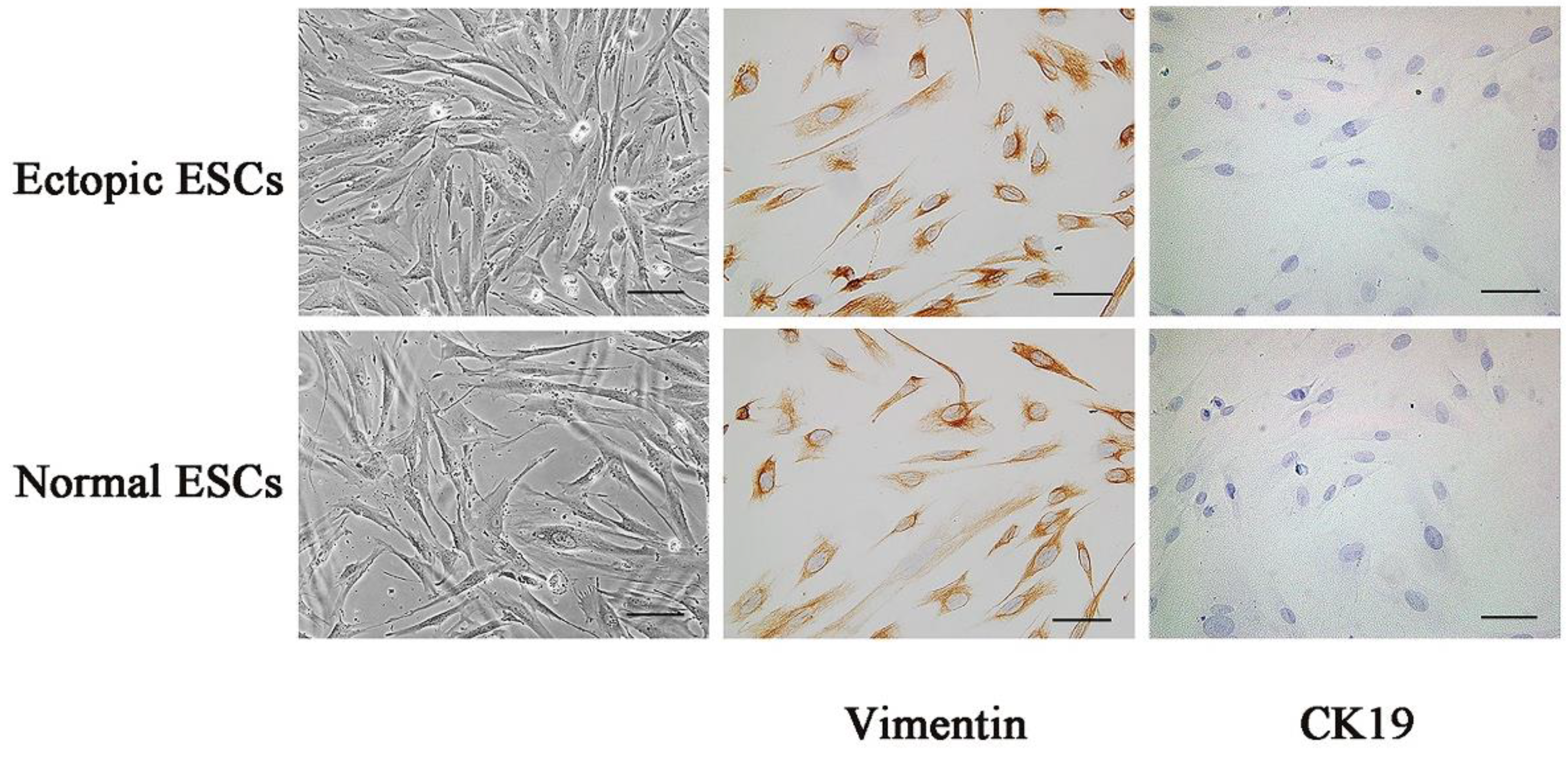 完璧 ITCH-Mediated Ubiquitylation of ITGB3 Promotes Cell その他