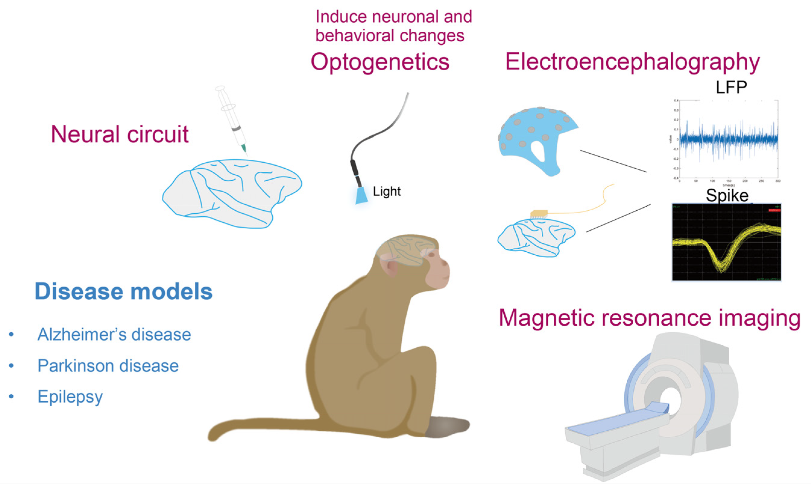 China Is Genetically Engineering Monkeys With Brain Disorders