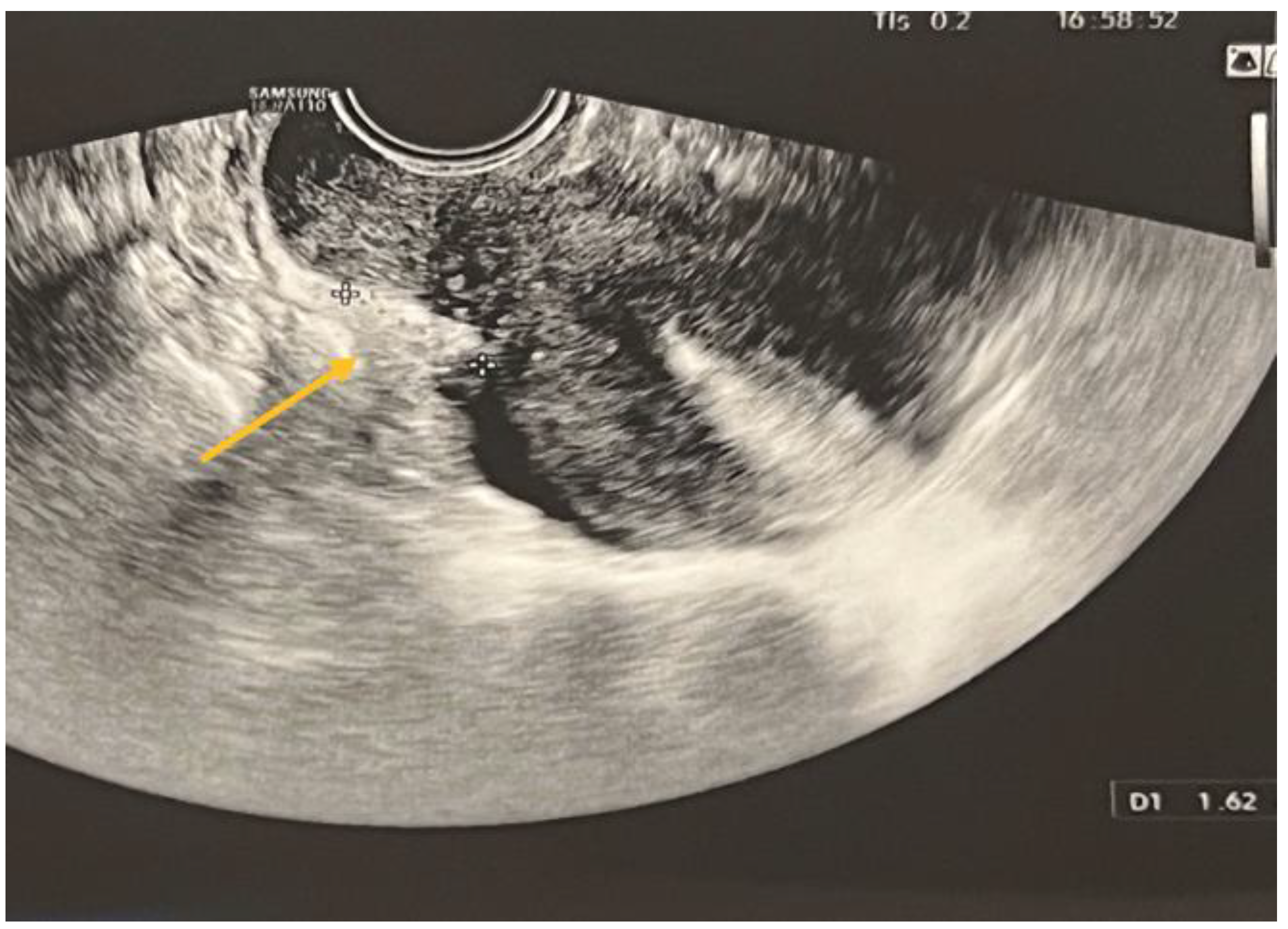 Biomedicines 11 02609 g005