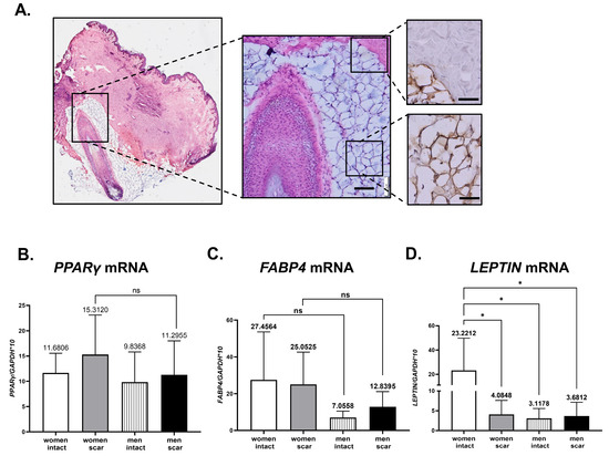 ホットなアイテム、ホットな節約 Gender Differences Skin Human Post-Operative in 食器
