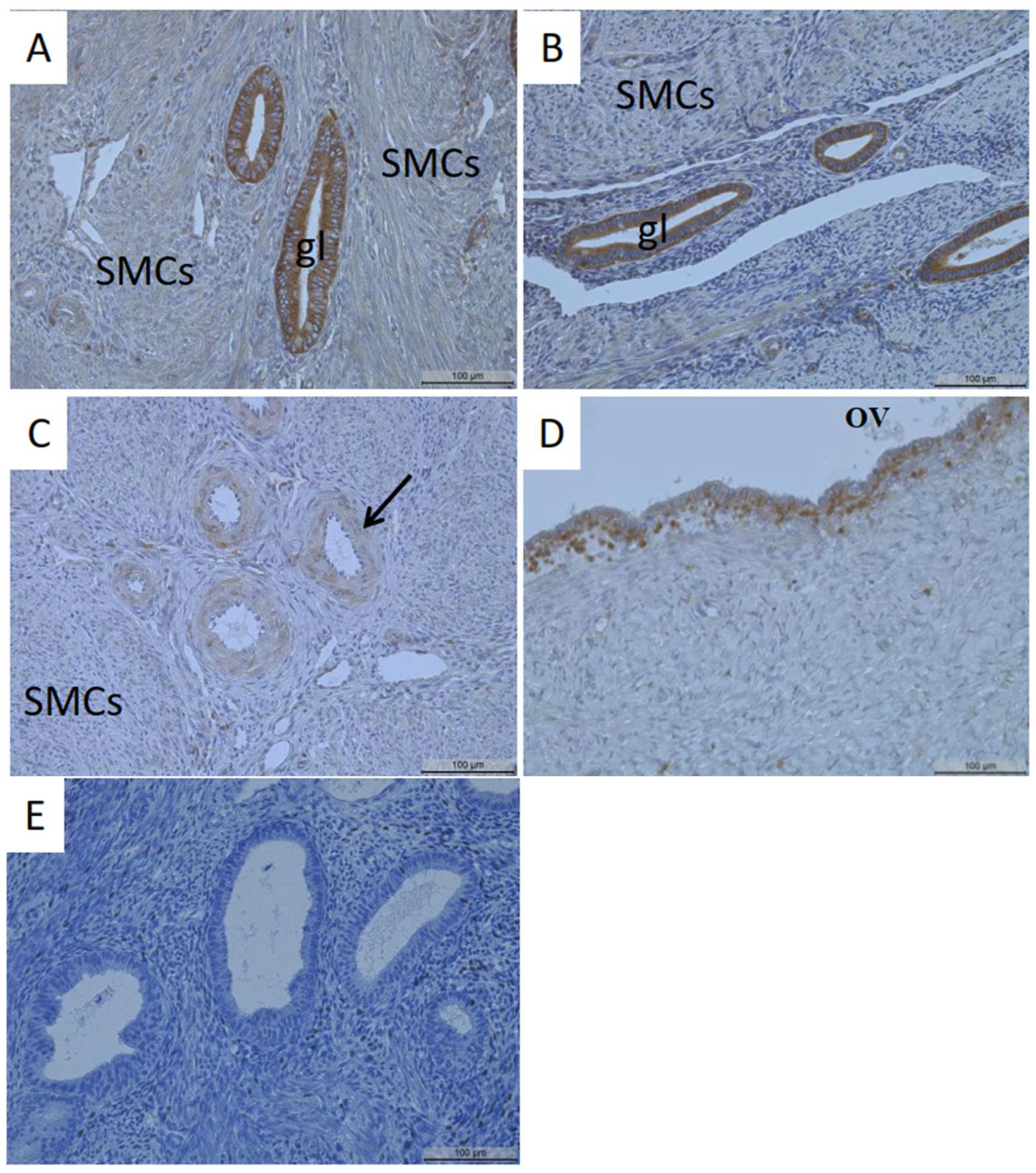 Analysis of Membrane Type-1 Matrix Metalloproteinase (MT1