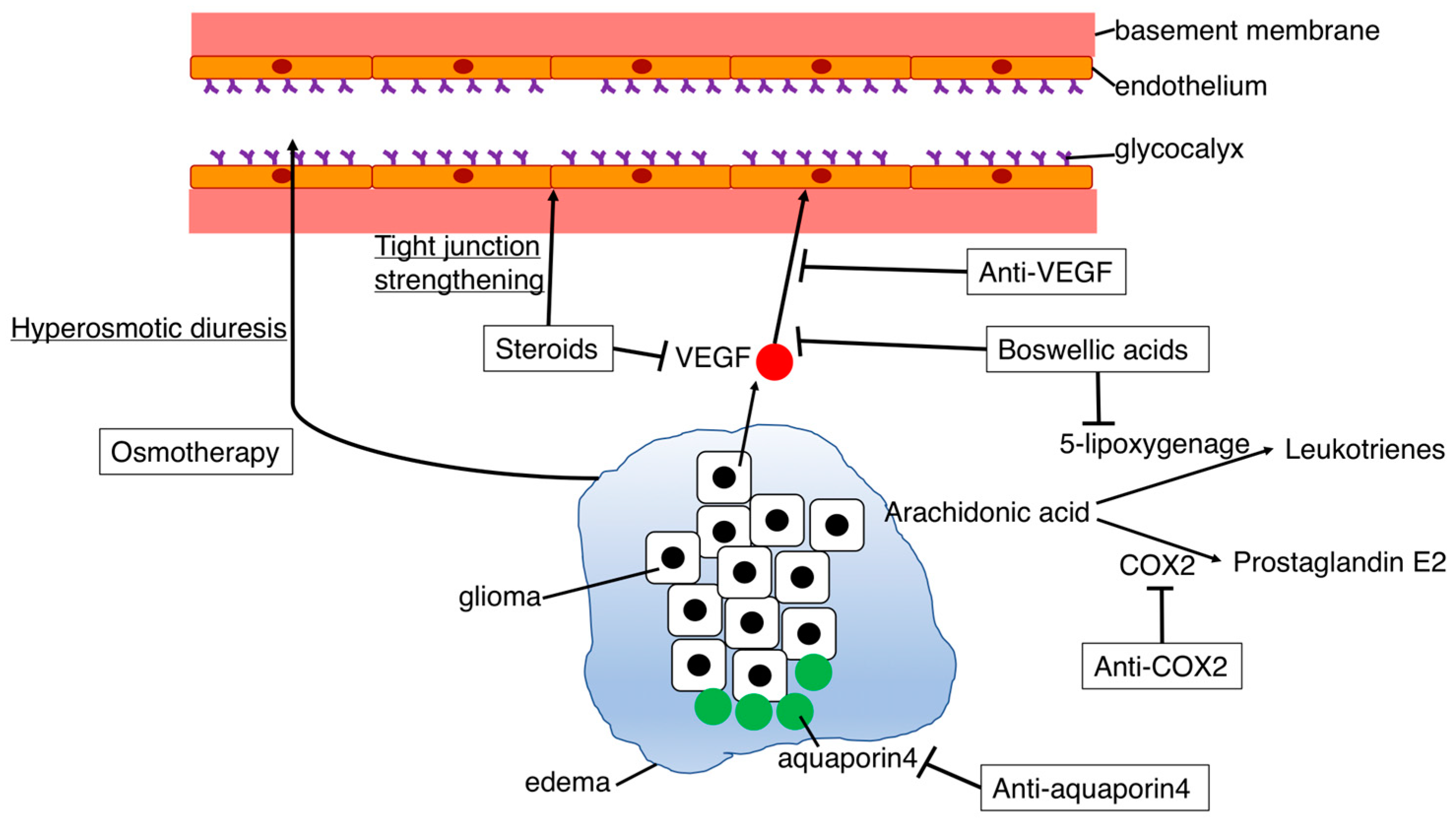 style.s 「Mind -Error-」［CD］ Peritumoral Edema in Gliomas: A Review of Mechanisms and