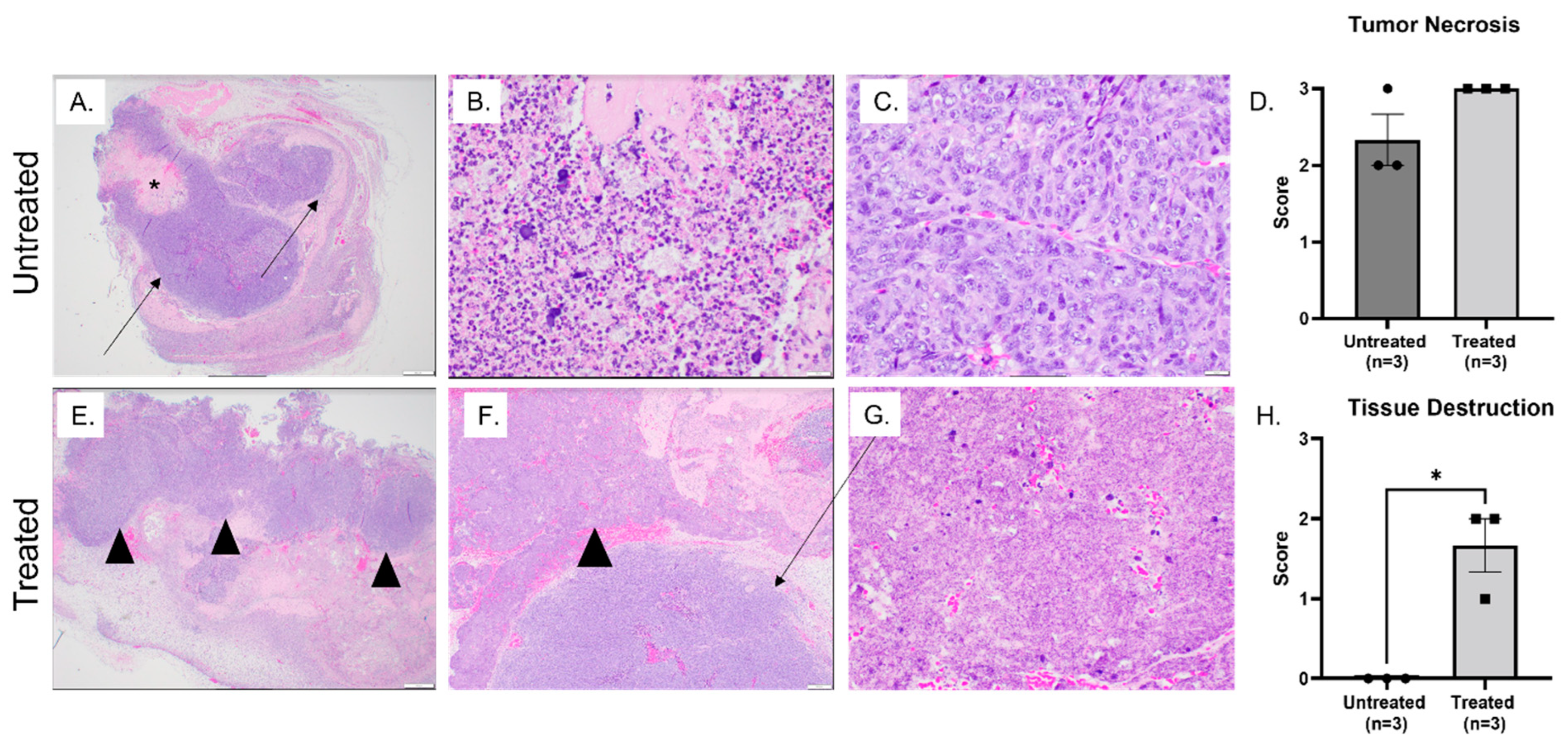 テスト Ablative and Immunostimulatory Effects of Histotripsy