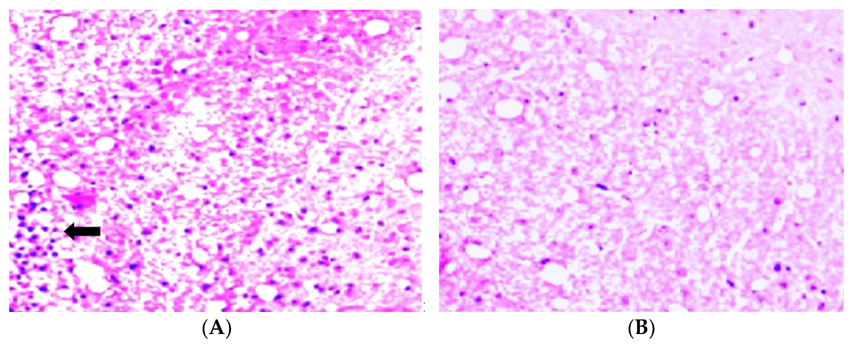 Biomedicines 11 02855 g006