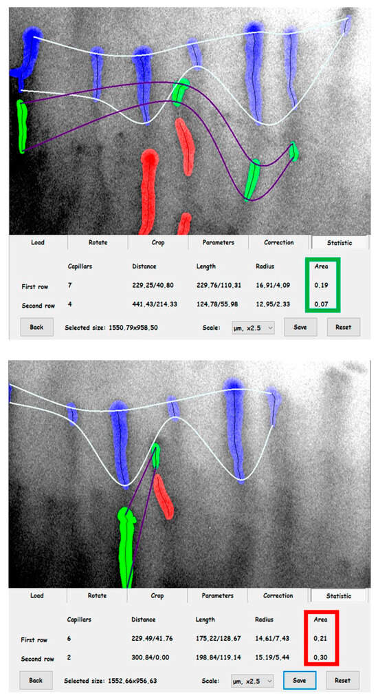 Biomedicines | Free Full-Text | The Relationship between TNF-a, IL-35 ...