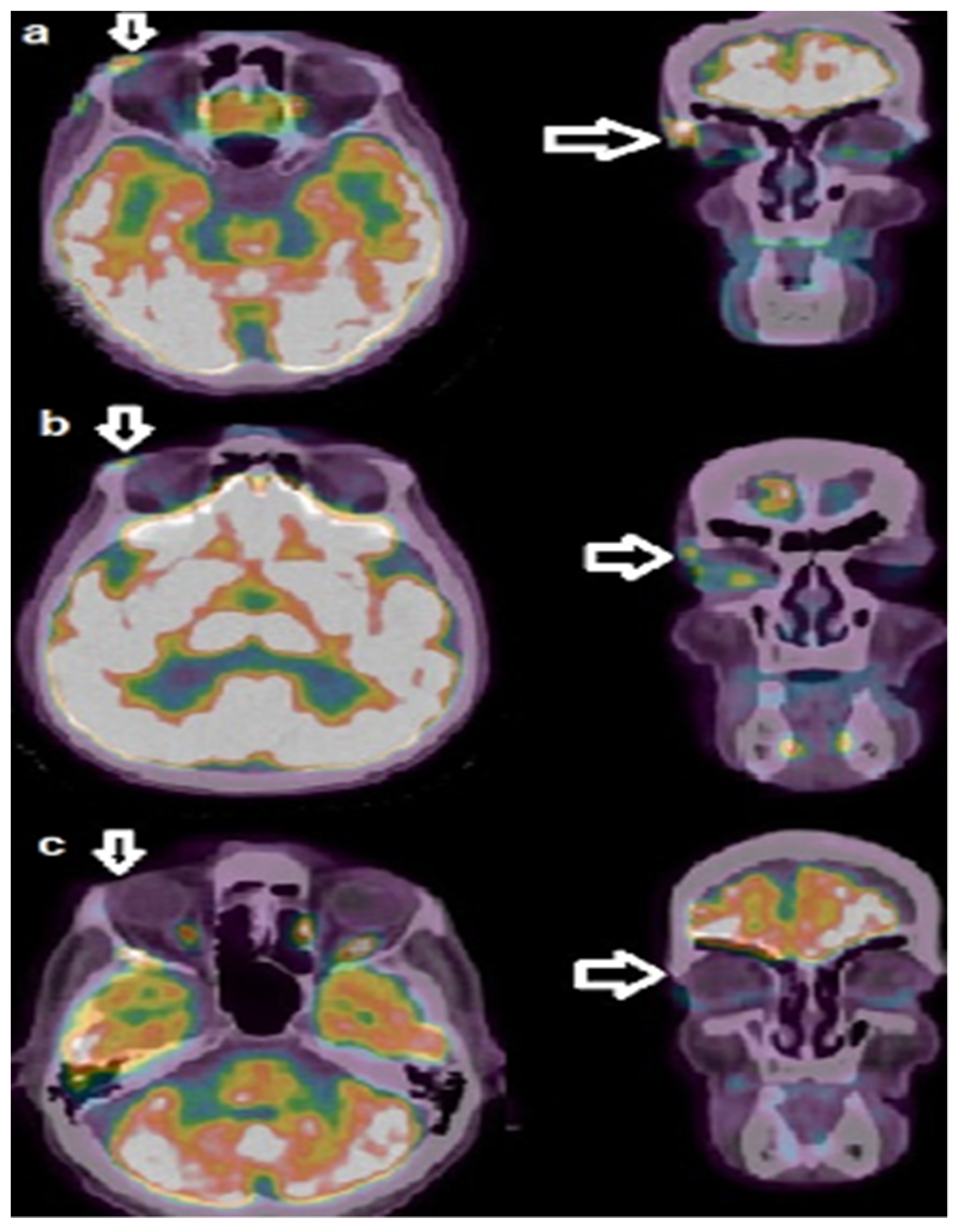 Biomedicines 11 02903 g003