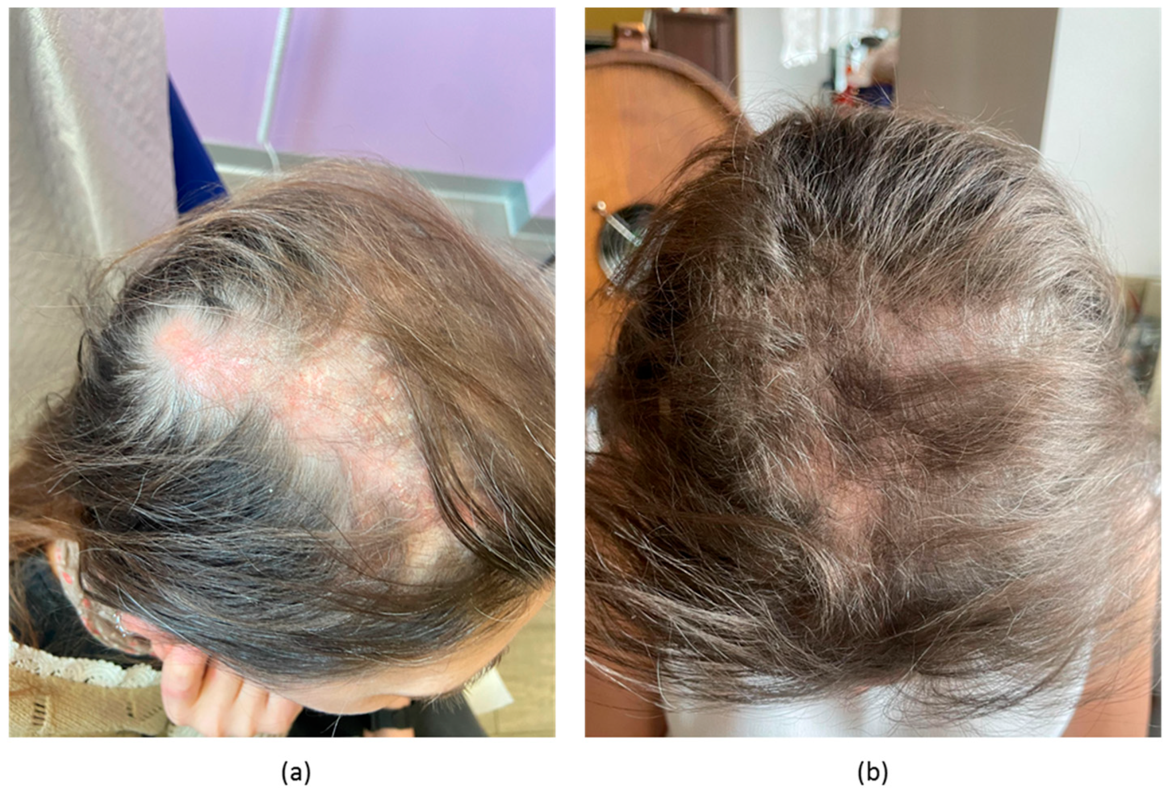 Biomedicines 11 02904 g004