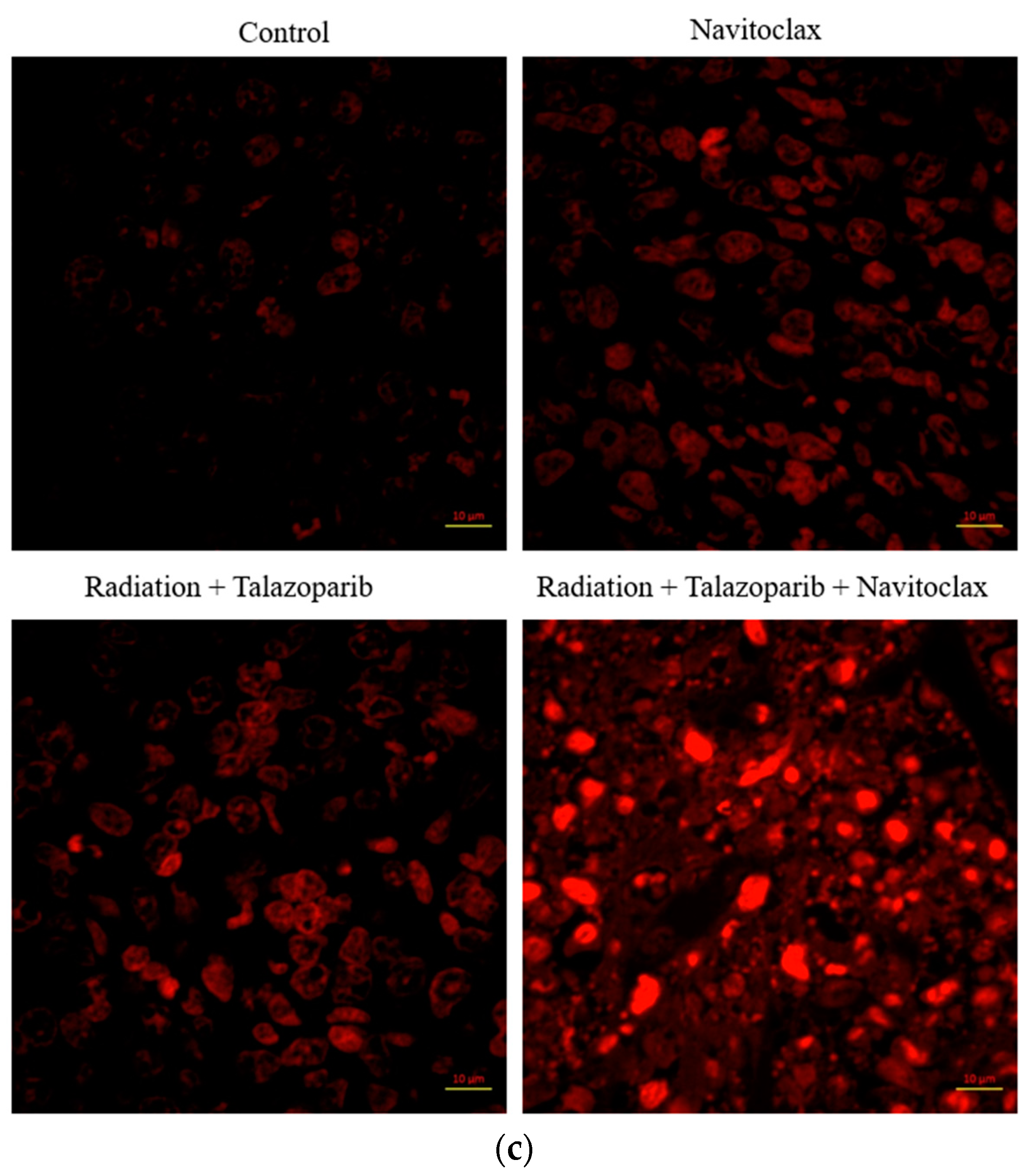 Biomedicines 11 03066 g004b