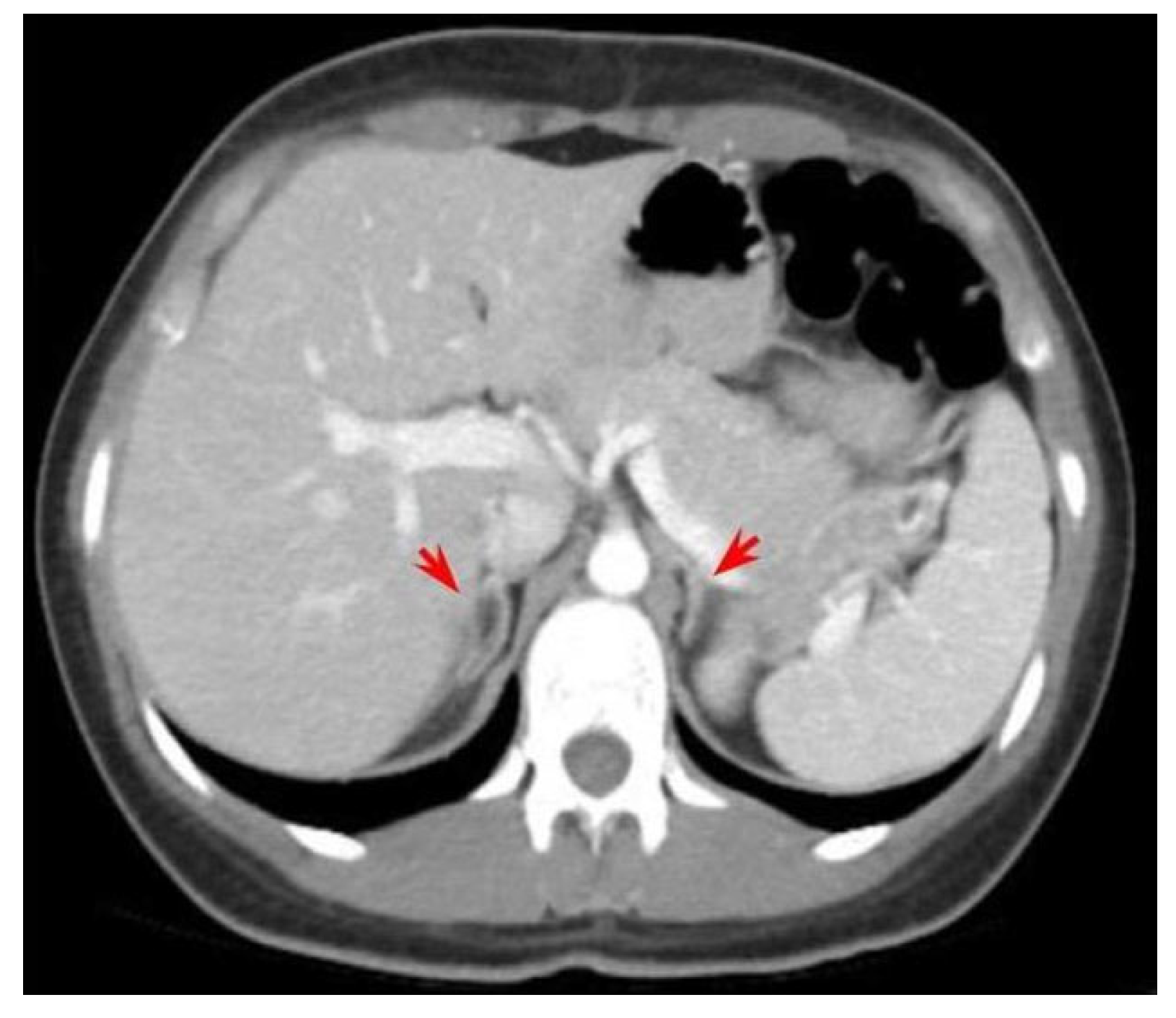Biomedicines 11 03081 g003