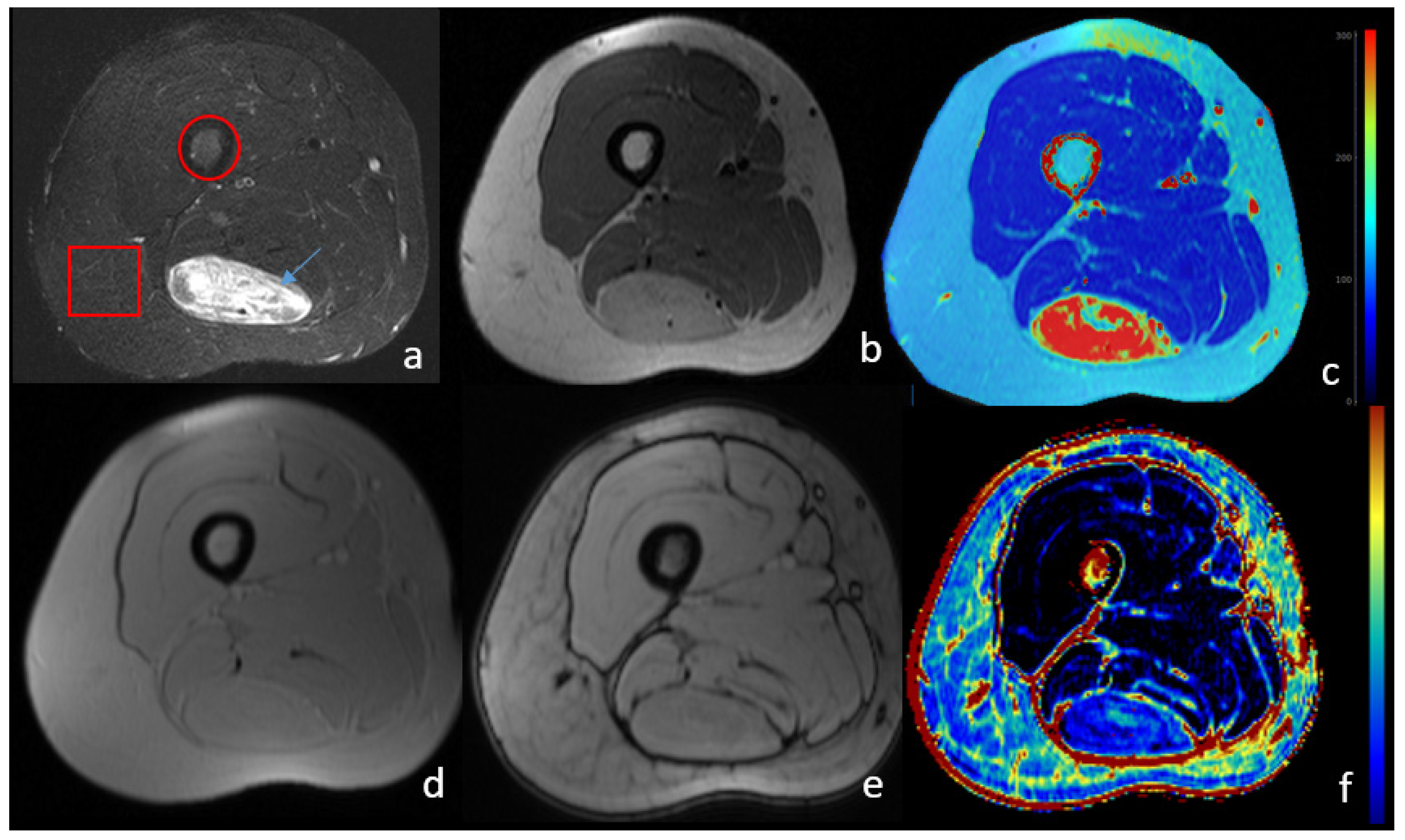 Biomedicines 11 03179 g001