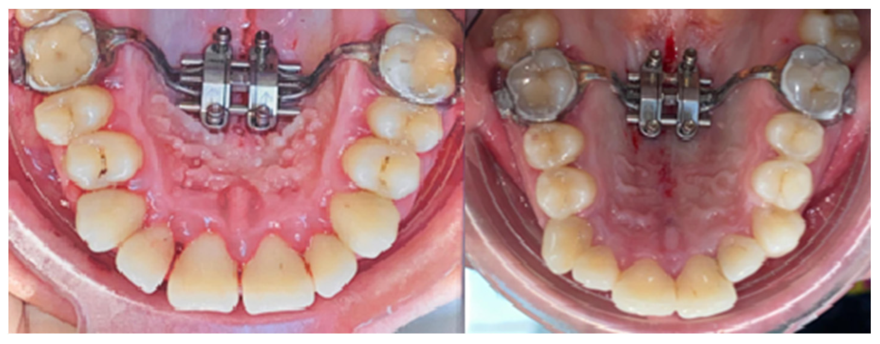 Biomedicines 11 03246 g003 Biomedicines 11 03246 g003