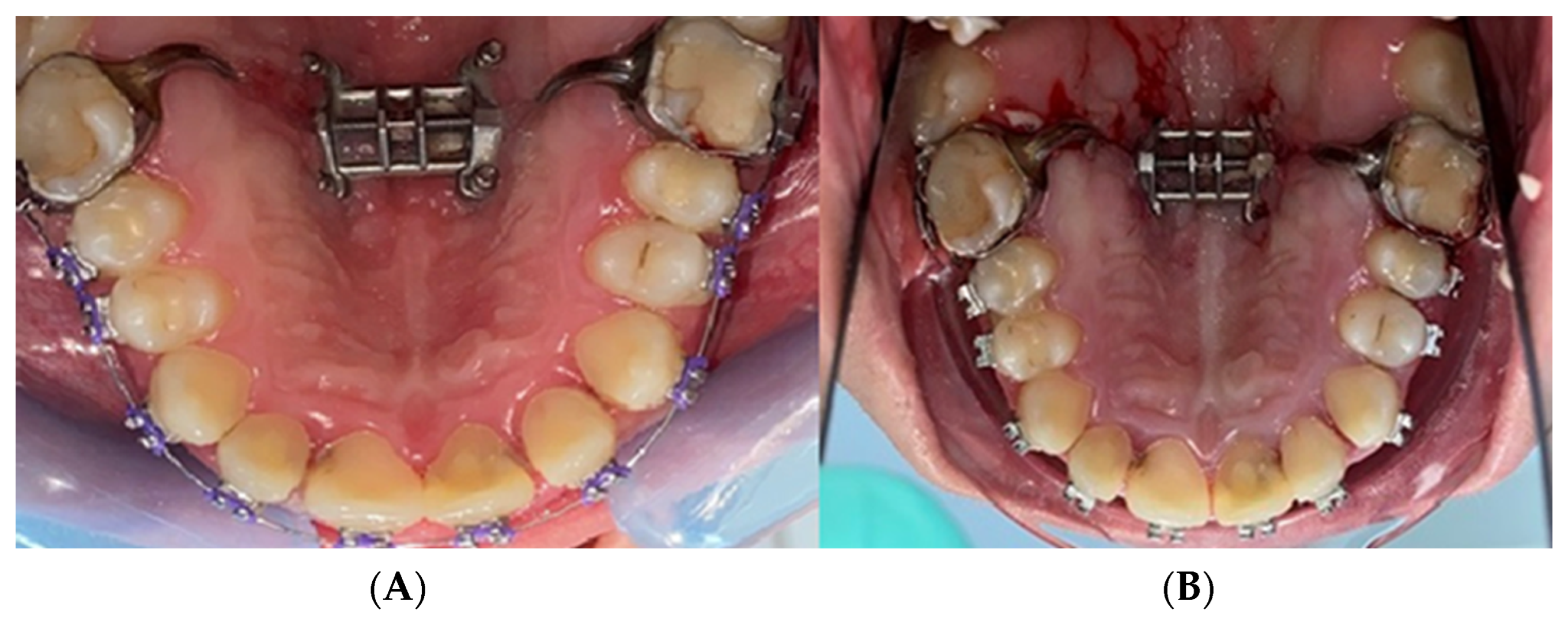 Biomedicines 11 03246 g005 Biomedicines 11 03246 g005