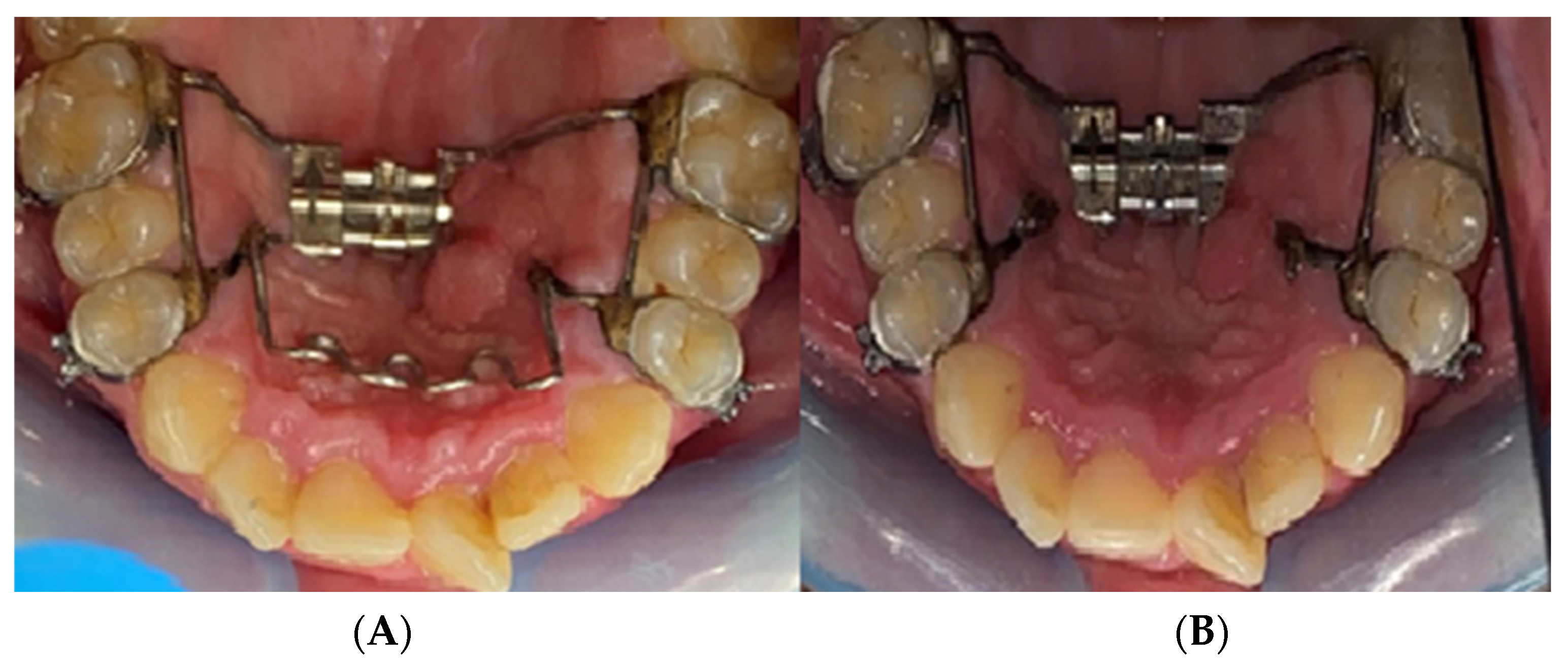 Biomedicines 11 03246 g006 Biomedicines 11 03246 g006