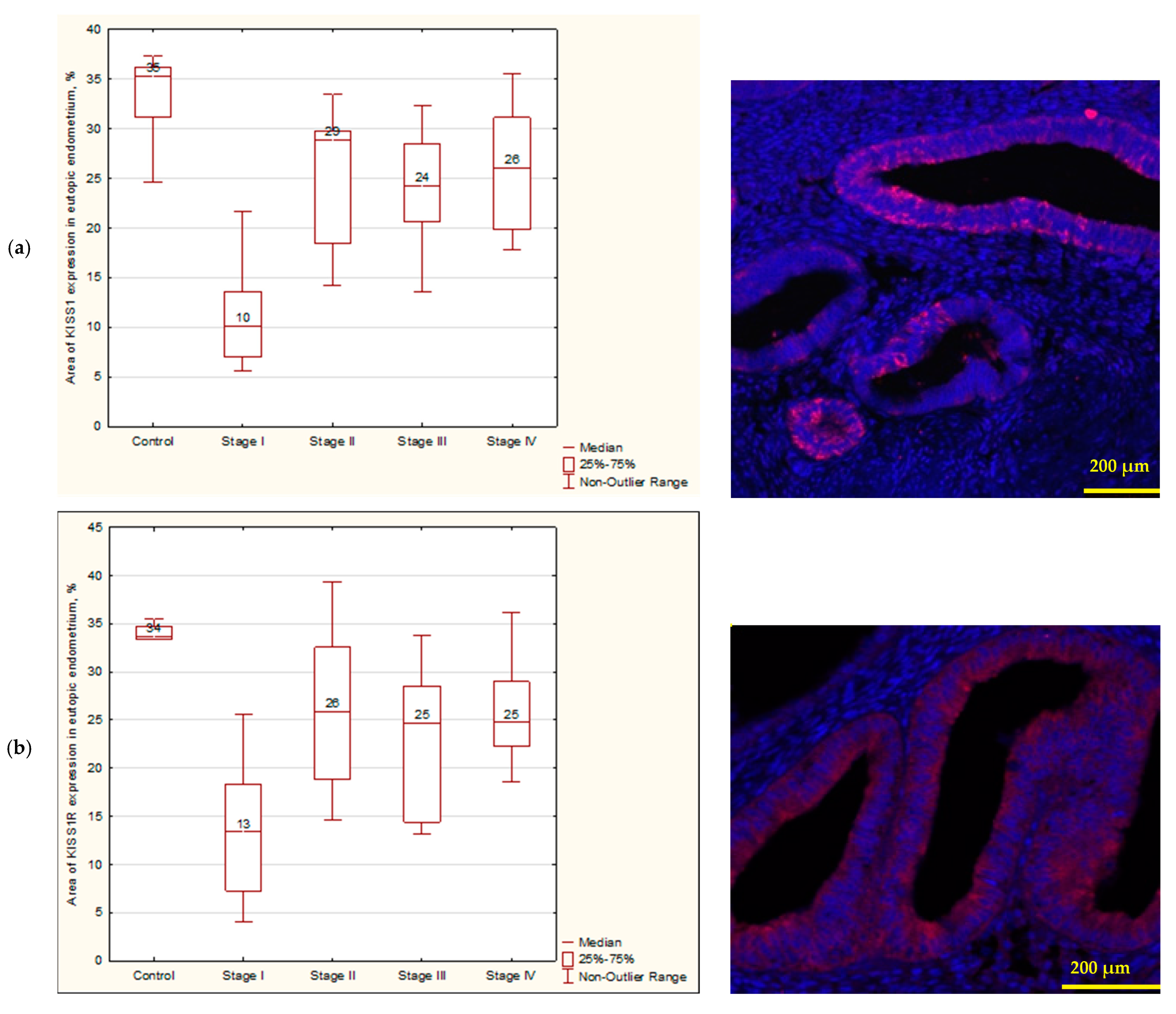 Biomedicines 12 00094 g002a