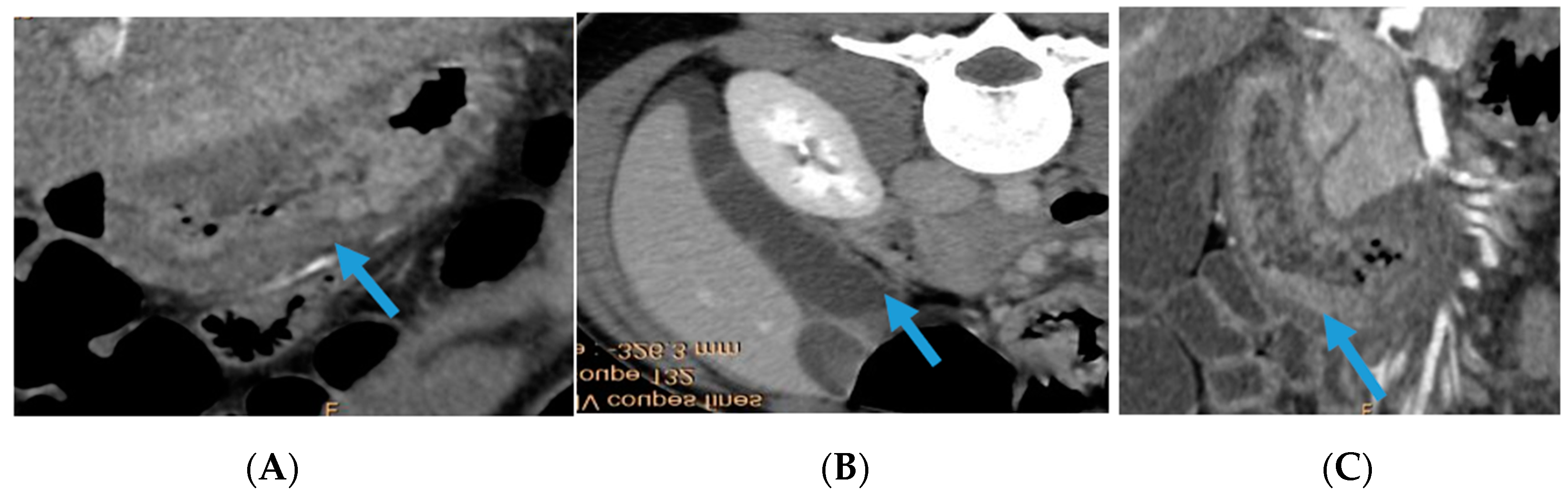 Biomedicines 12 00117 g001