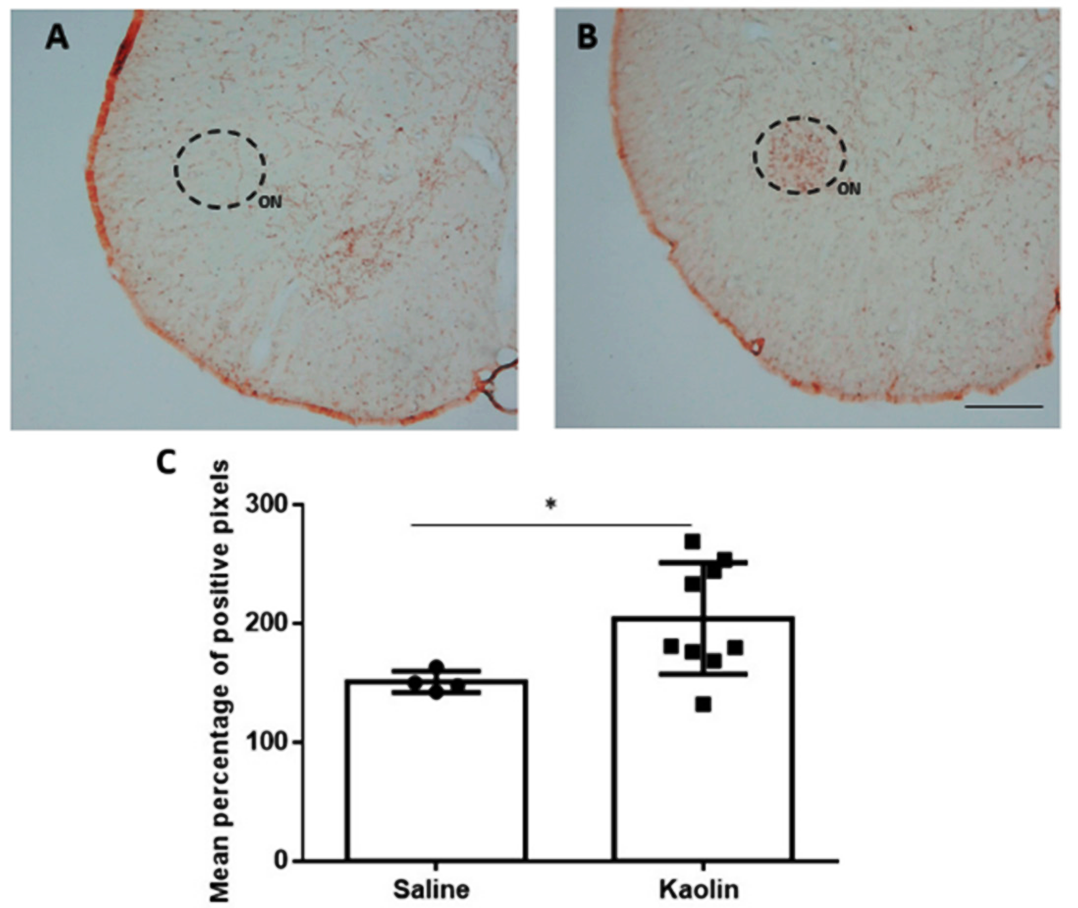 Biomedicines 12 00215 g002 Biomedicines 12 00215 g002