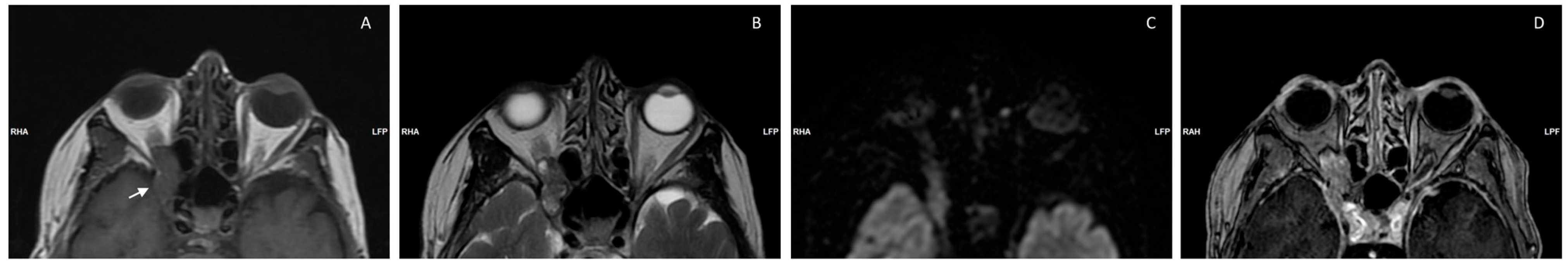 Biomedicines 12 00379 g002