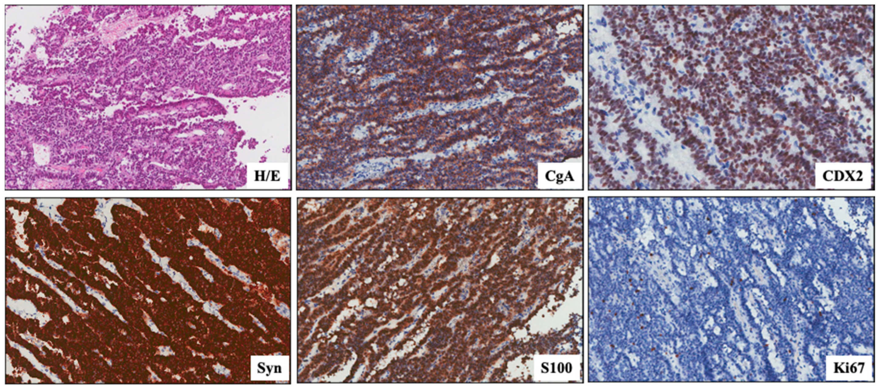 Biomedicines 12 00379 g004