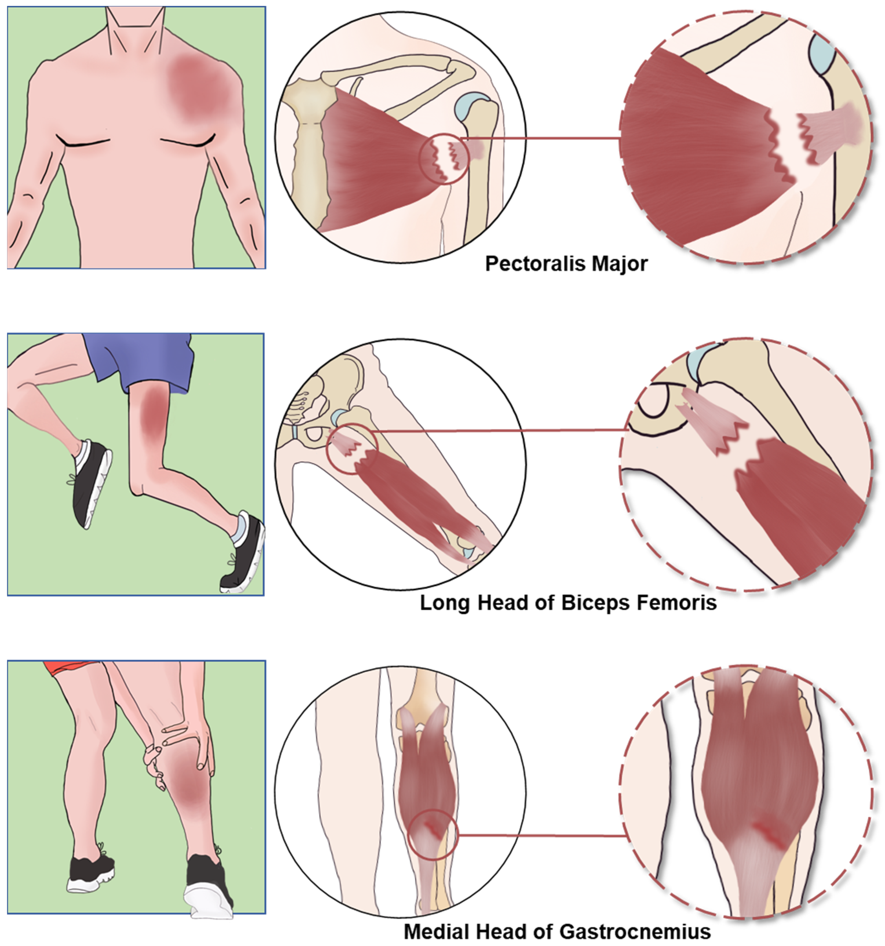 Biomedicines 12 00423 g003 Biomedicines 12 00423 g003