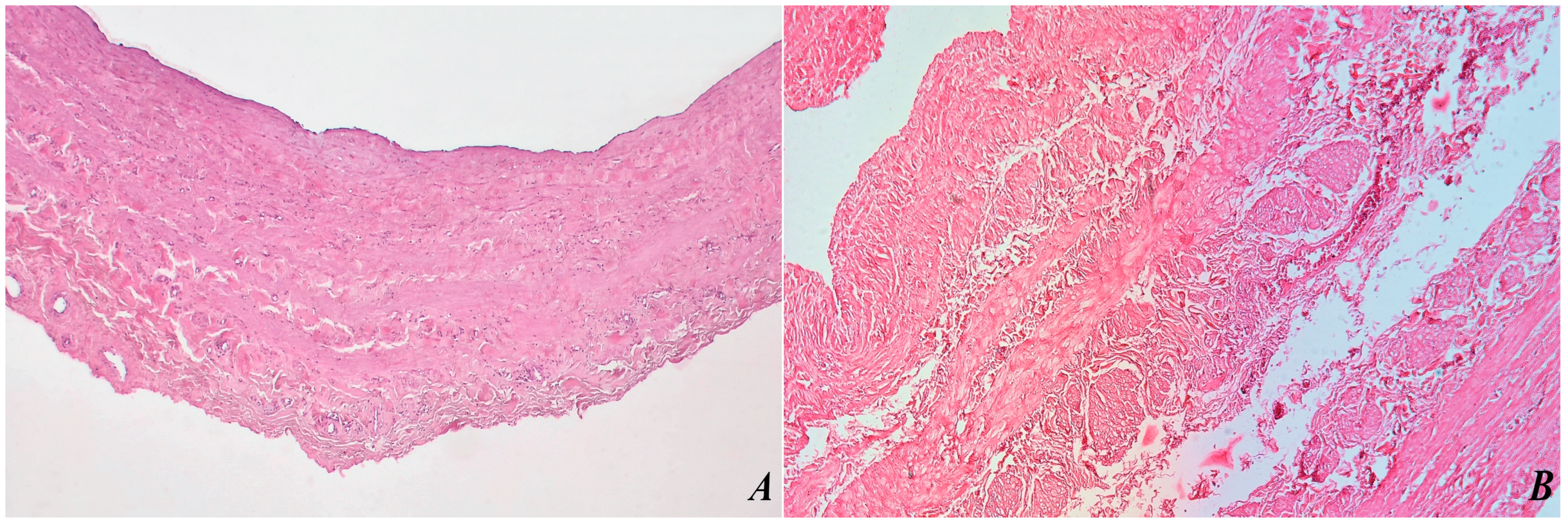 Biomedicines 12 00476 g003 Biomedicines 12 00476 g003