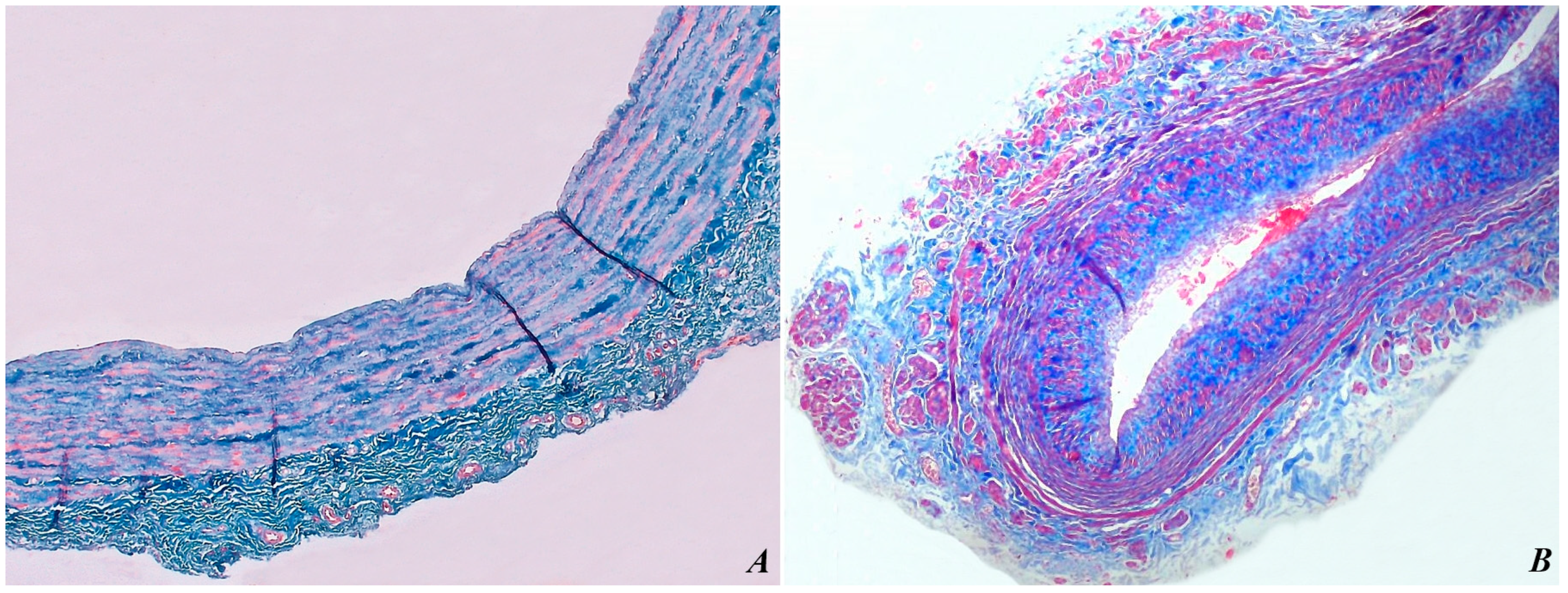 Biomedicines 12 00476 g004 Biomedicines 12 00476 g004