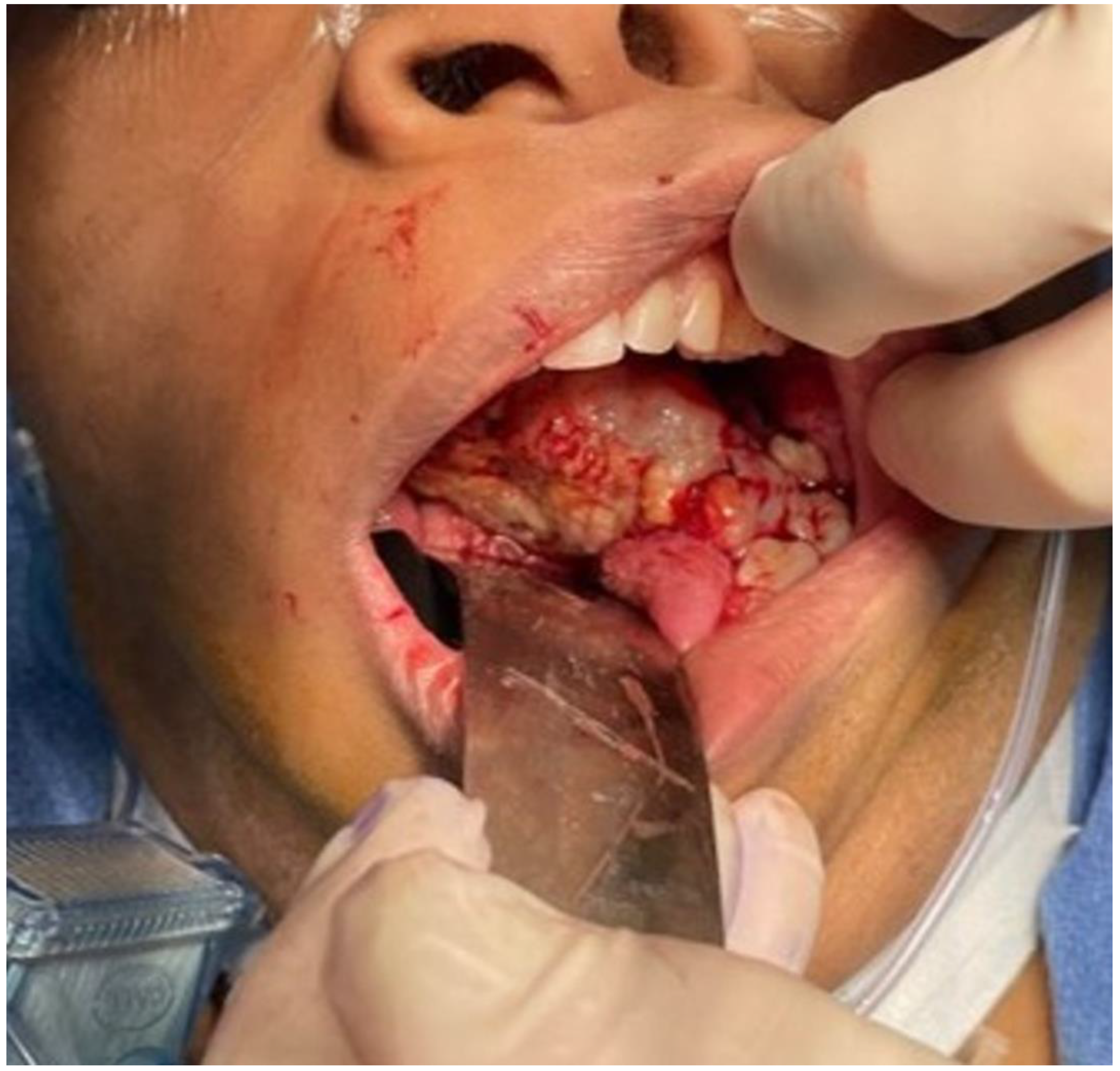 Biomedicines 12 00615 g001