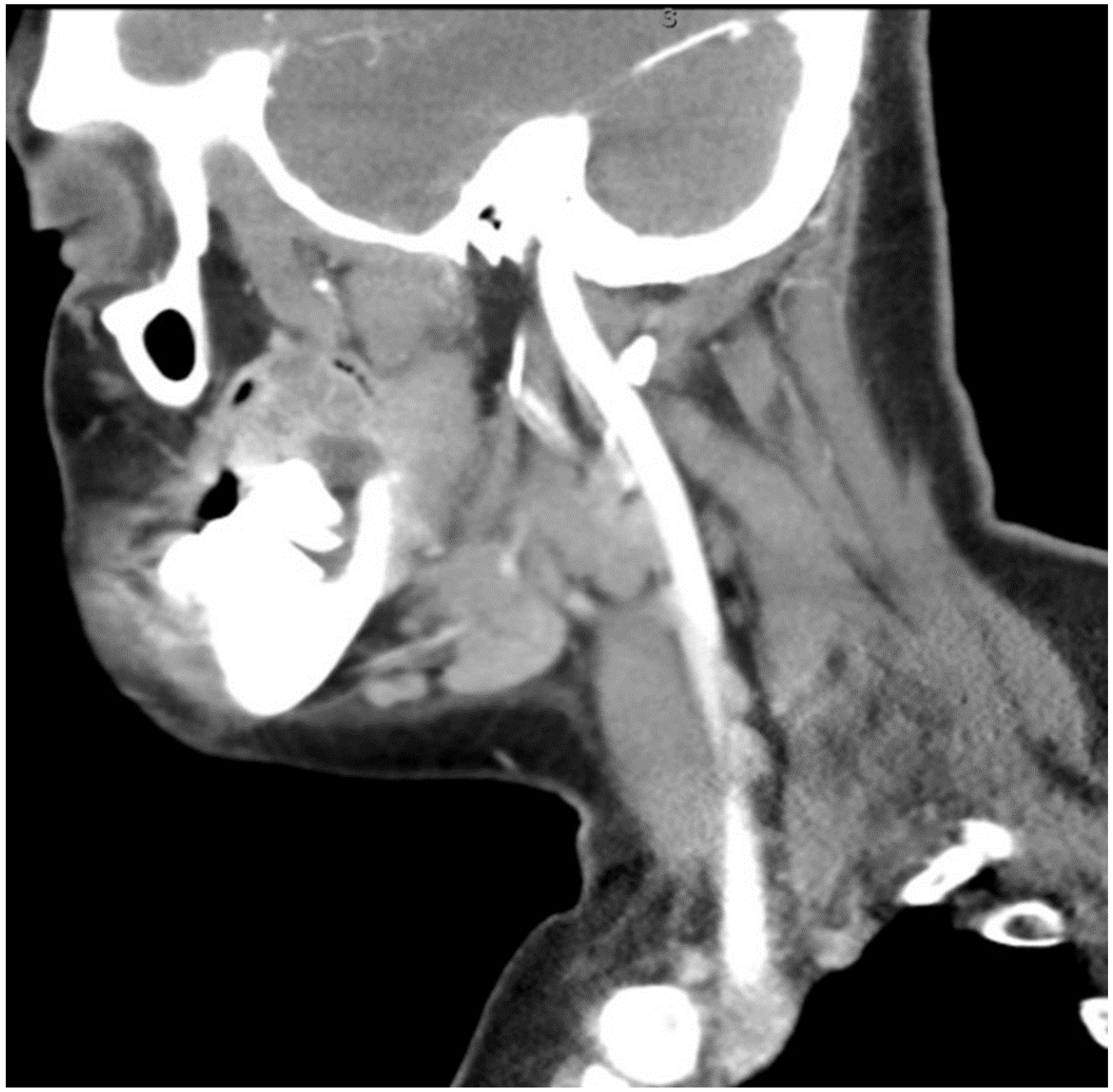 Biomedicines 12 00615 g003