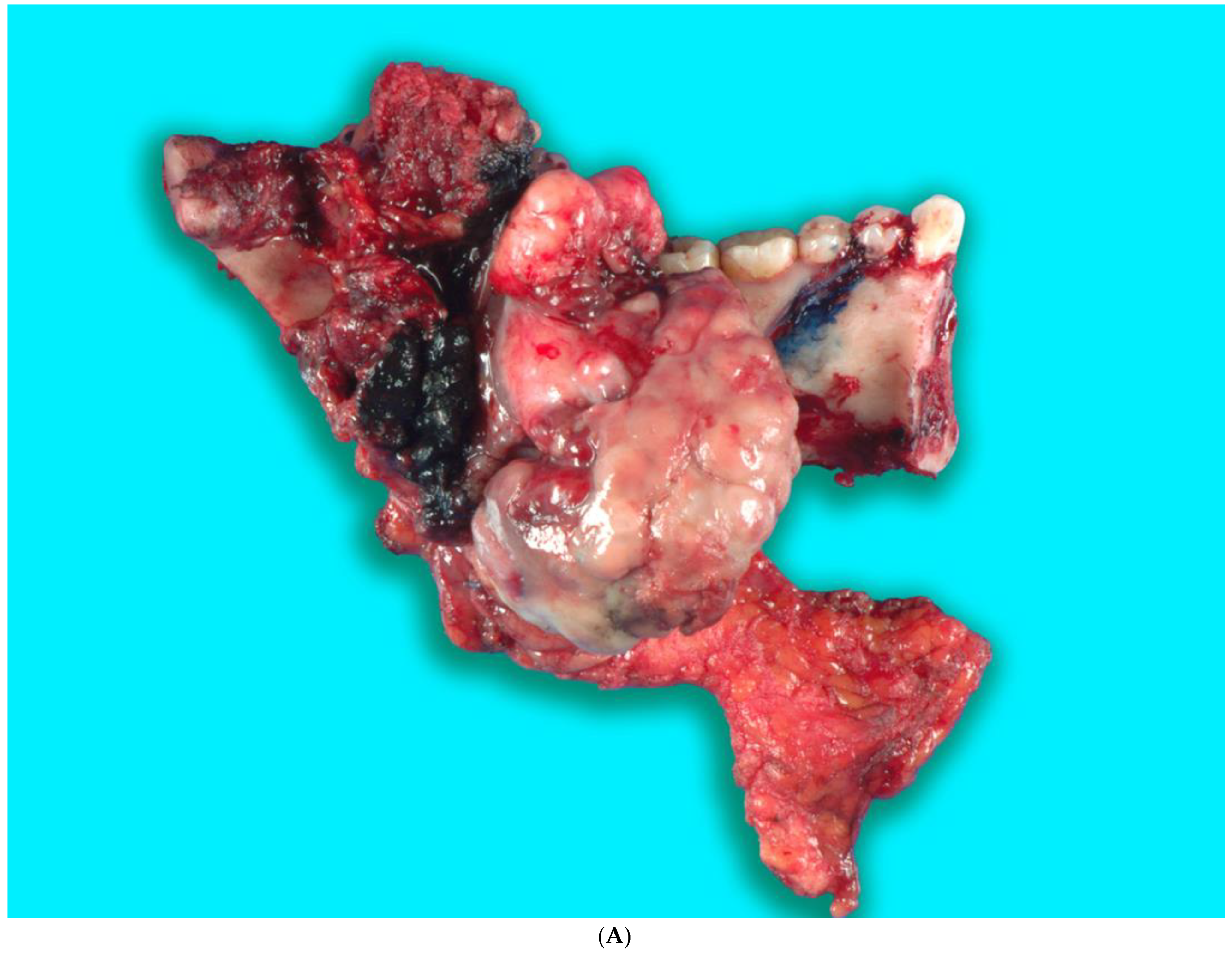 Biomedicines 12 00615 g009a