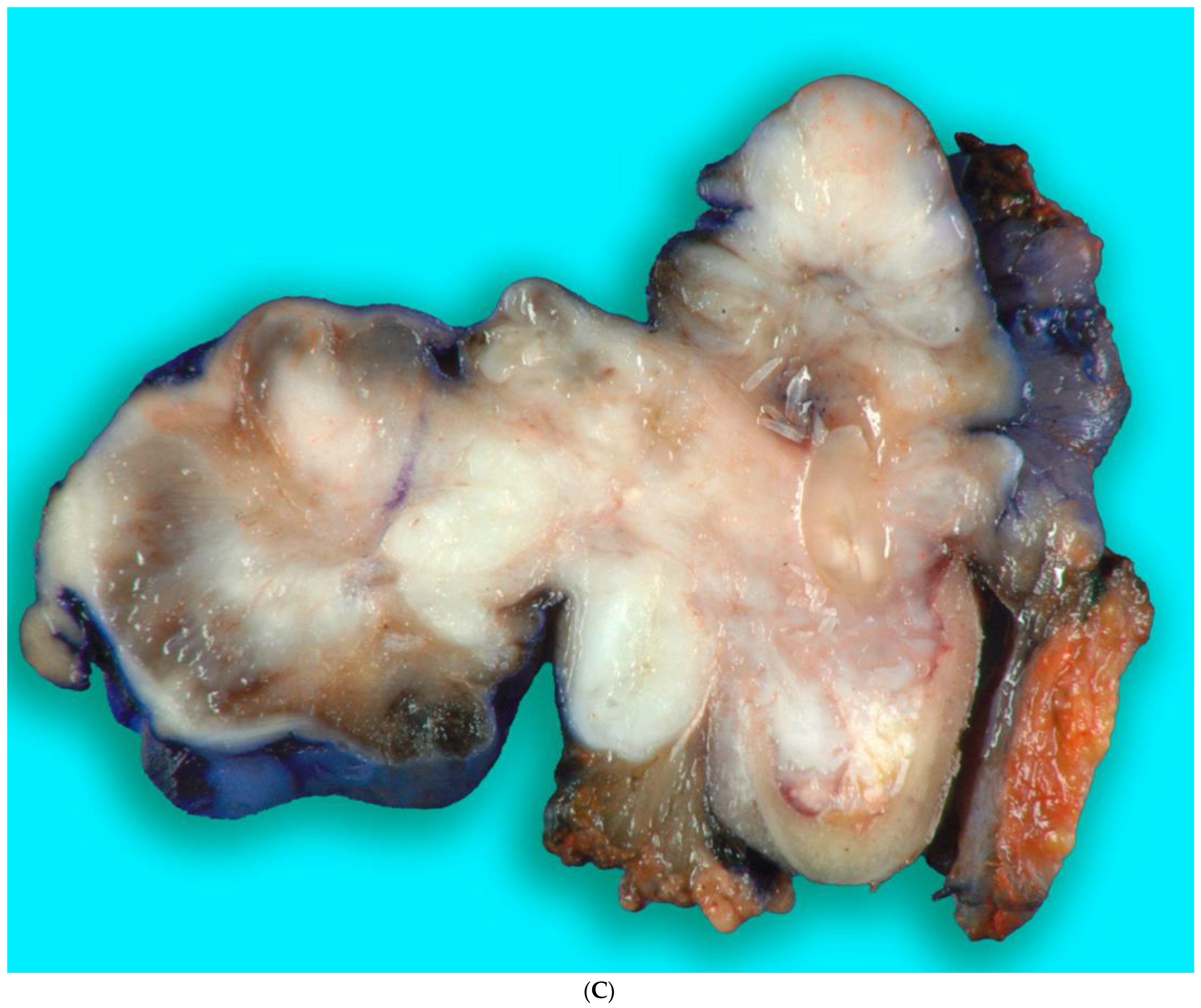 Biomedicines 12 00615 g009c