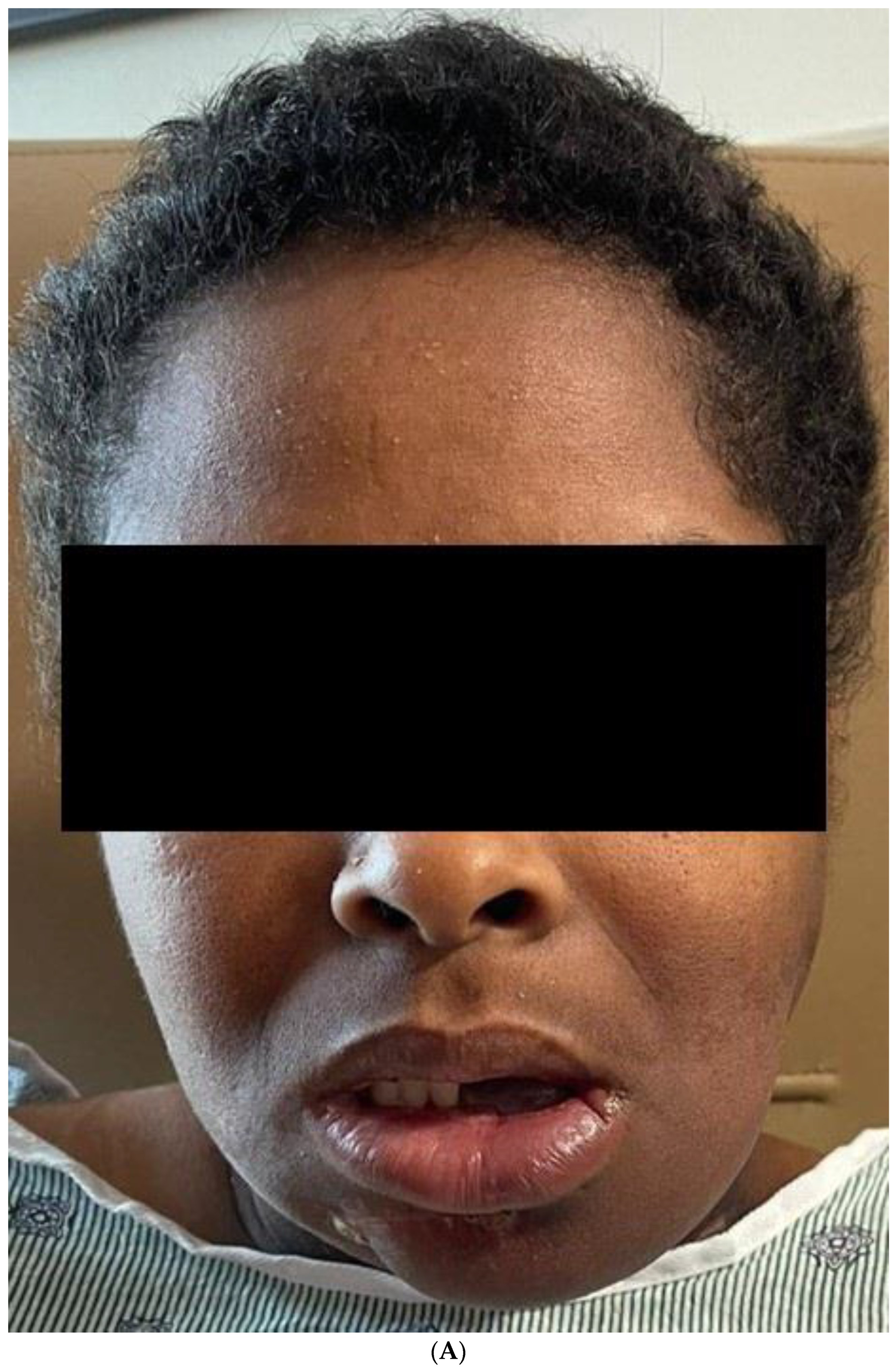 Biomedicines 12 00615 g011a