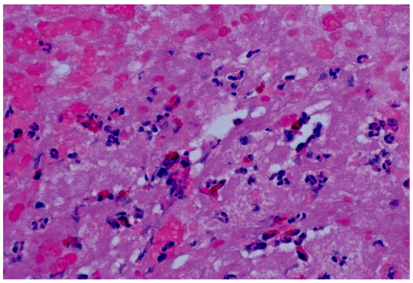 Biomedicines 12 00656 g004 Biomedicines 12 00656 g004