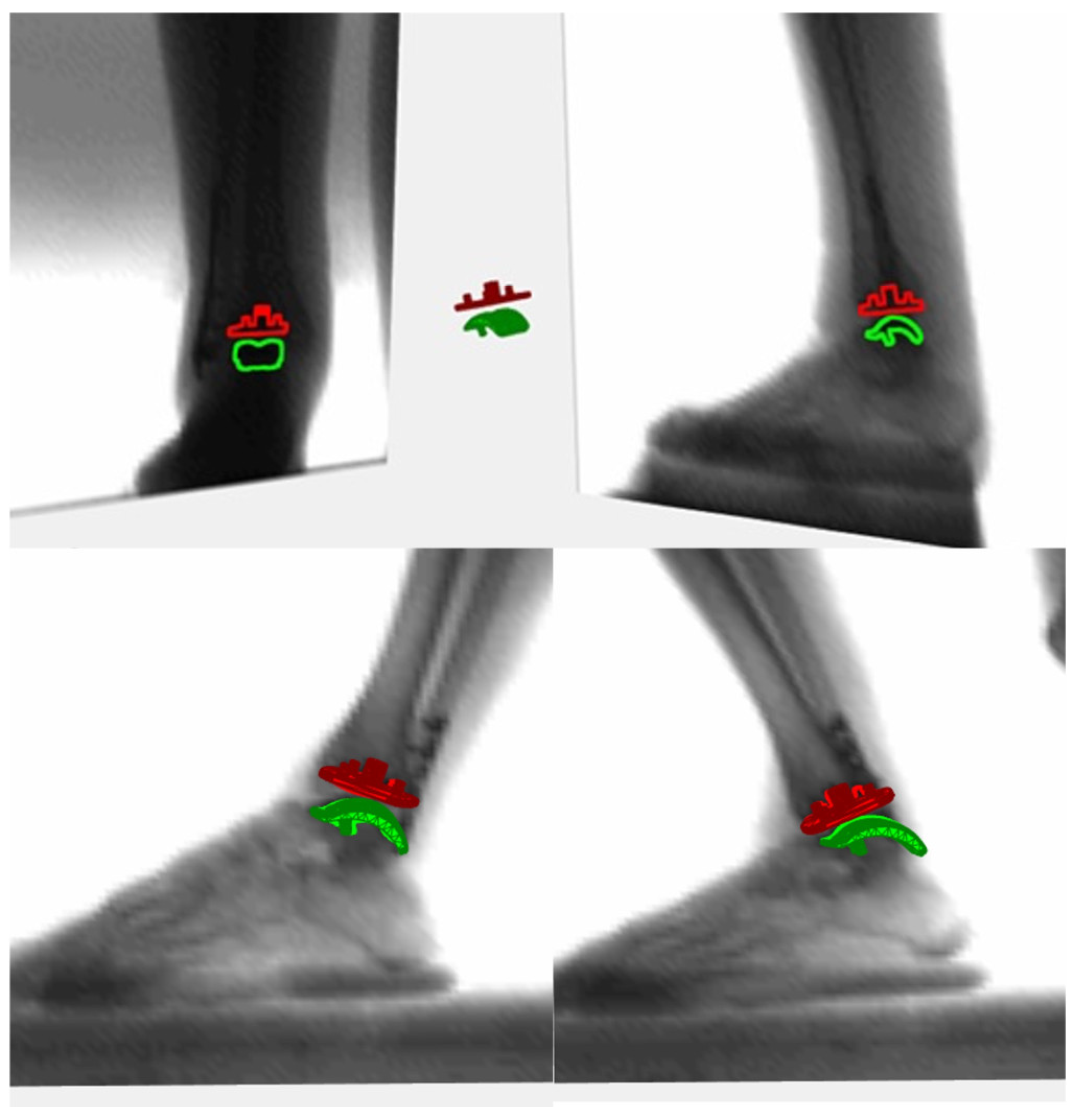 Biomedicines 12 00705 g005