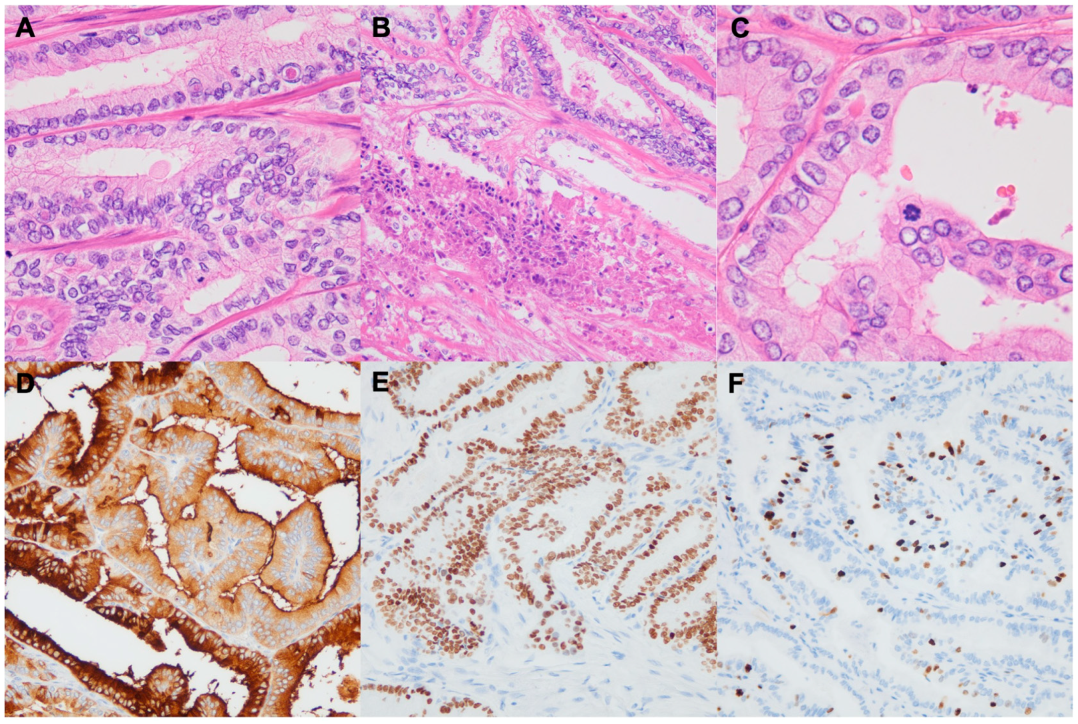 Biomedicines 12 00712 g003