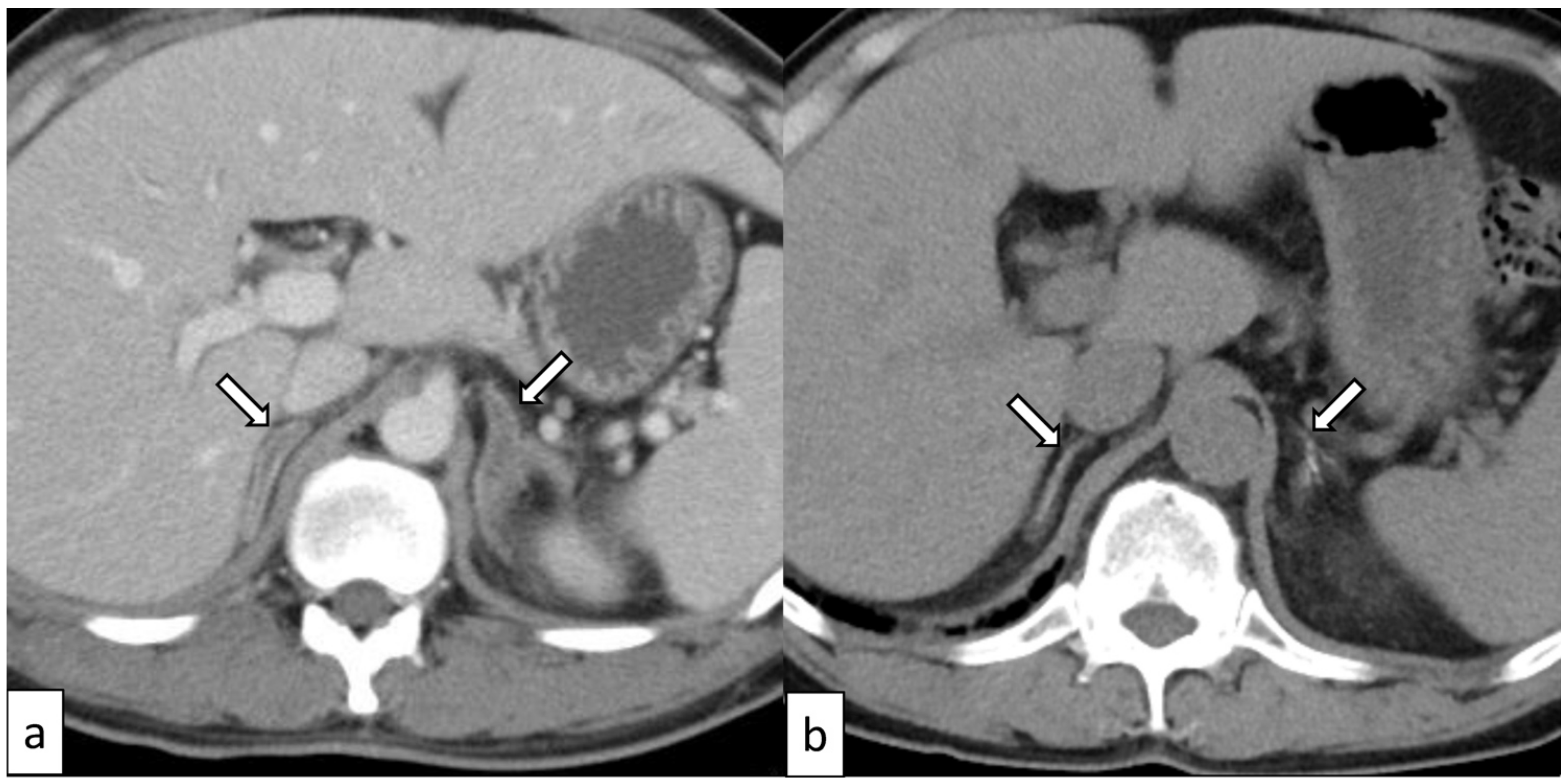 Biomedicines 12 00837 g002