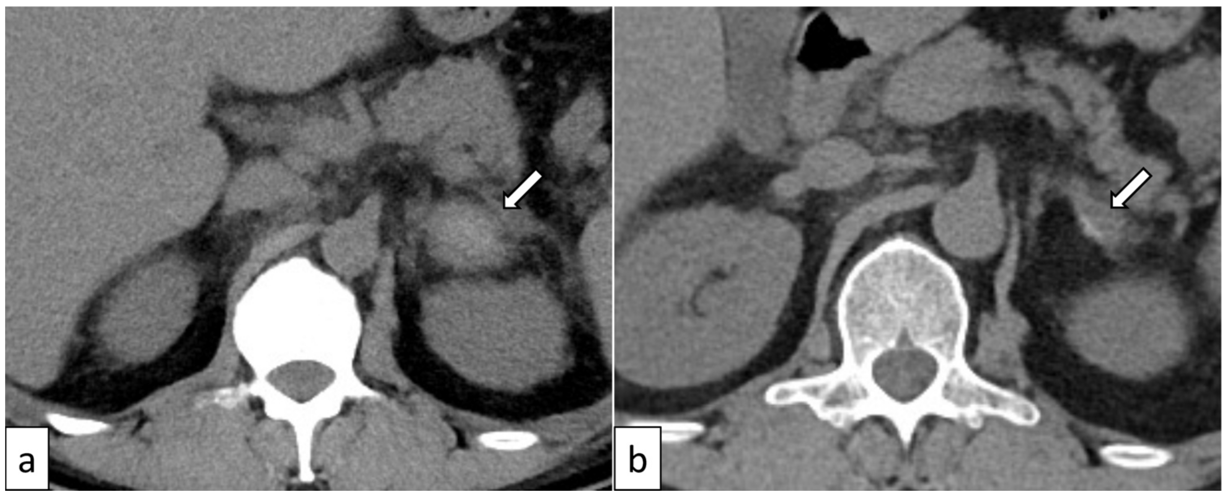 Biomedicines 12 00837 g003