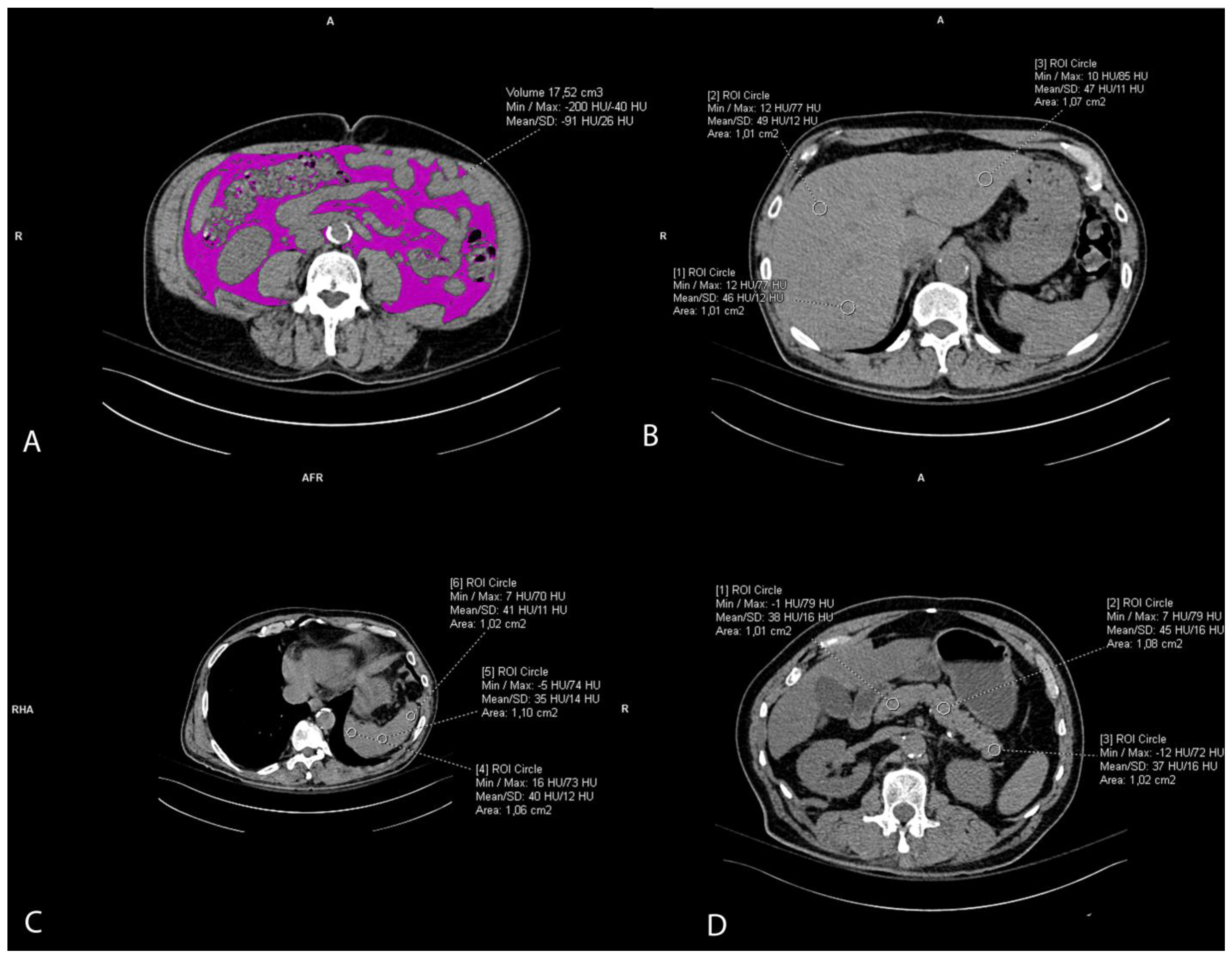 Biomedicines 12 00860 g002