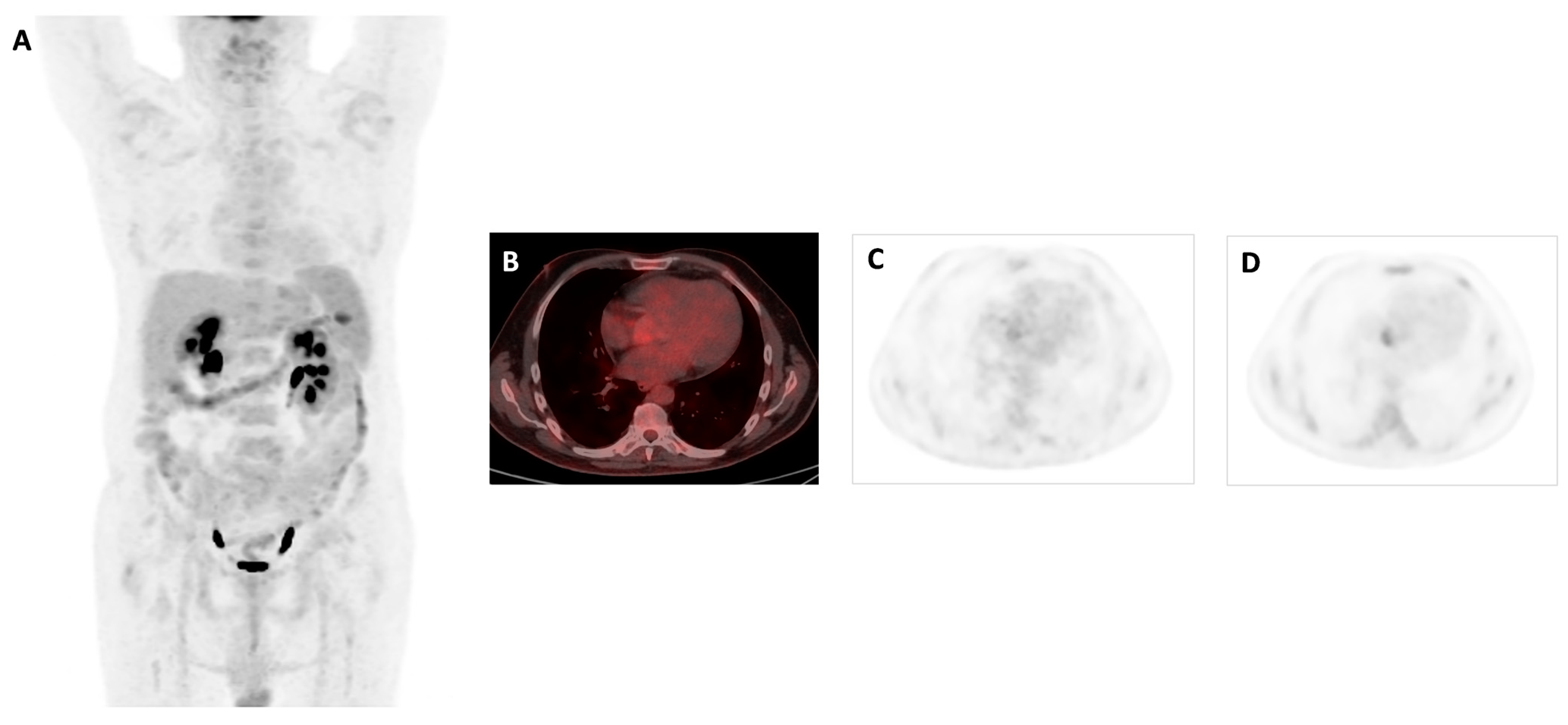 Biomedicines 12 00861 g002
