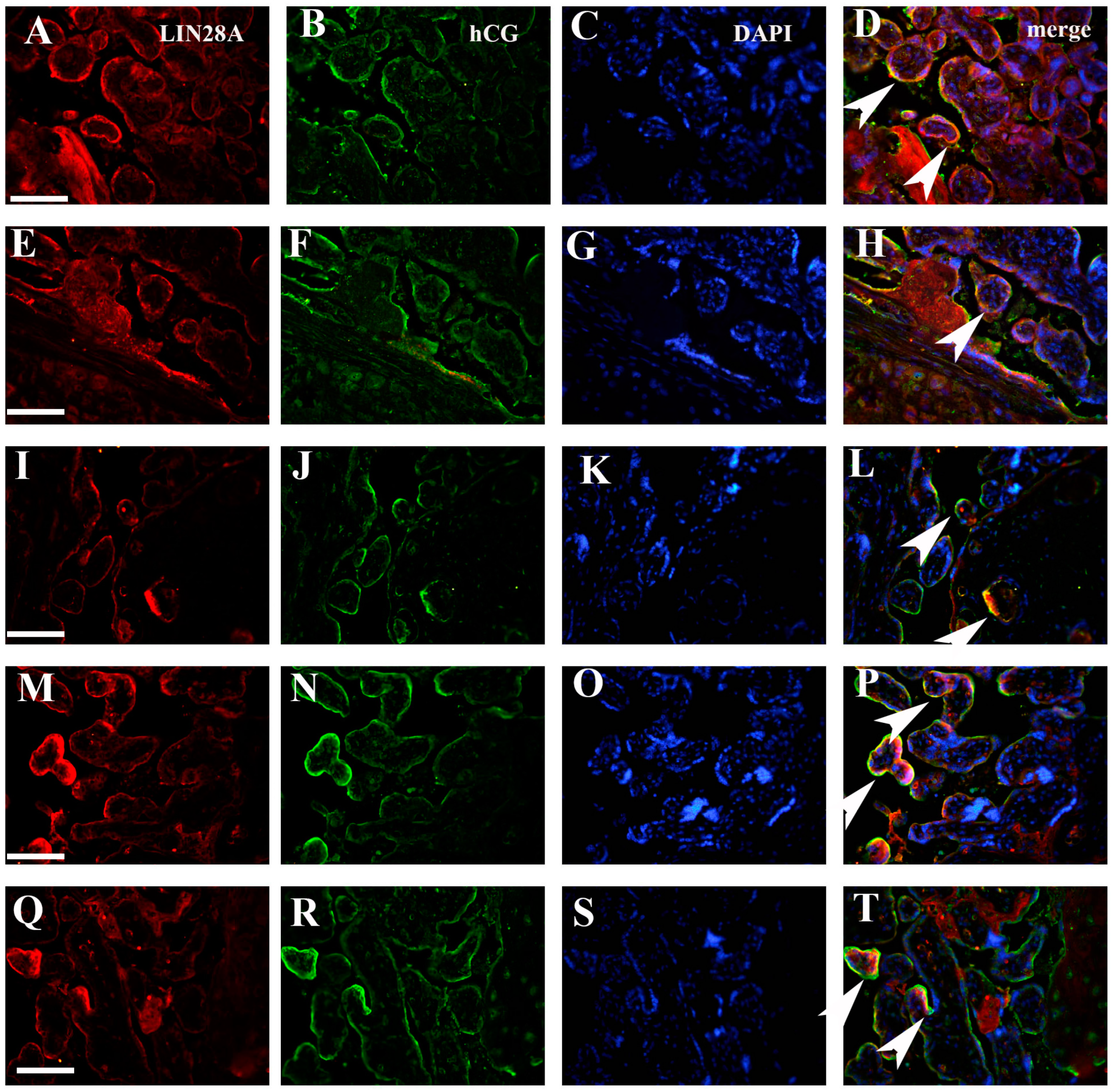 Biomedicines 12 00879 g006