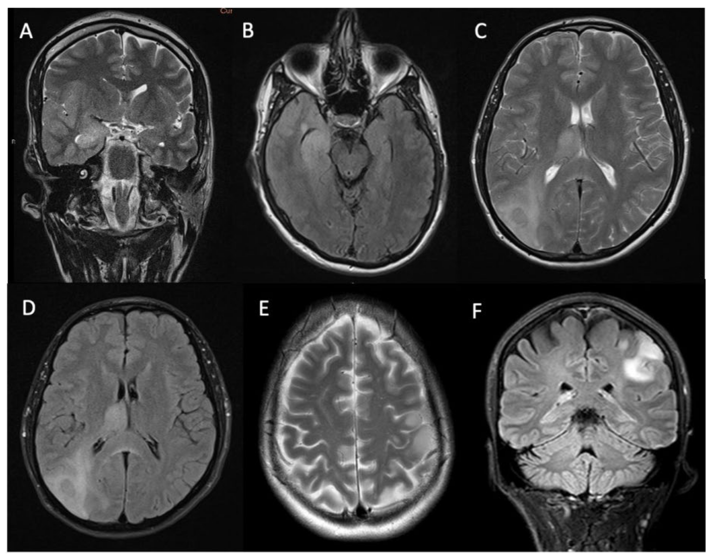 Biomedicines 12 00901 g001