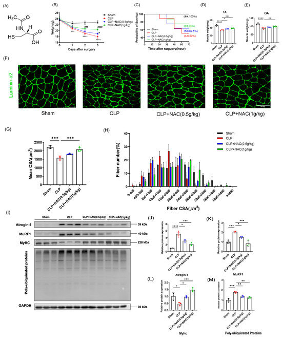 N-Acetylcysteine Attenuates Sepsis-Induced Muscle Atrophy by N-Acetylcysteine Attenuates Sepsis-Induced Muscle Atrophy by