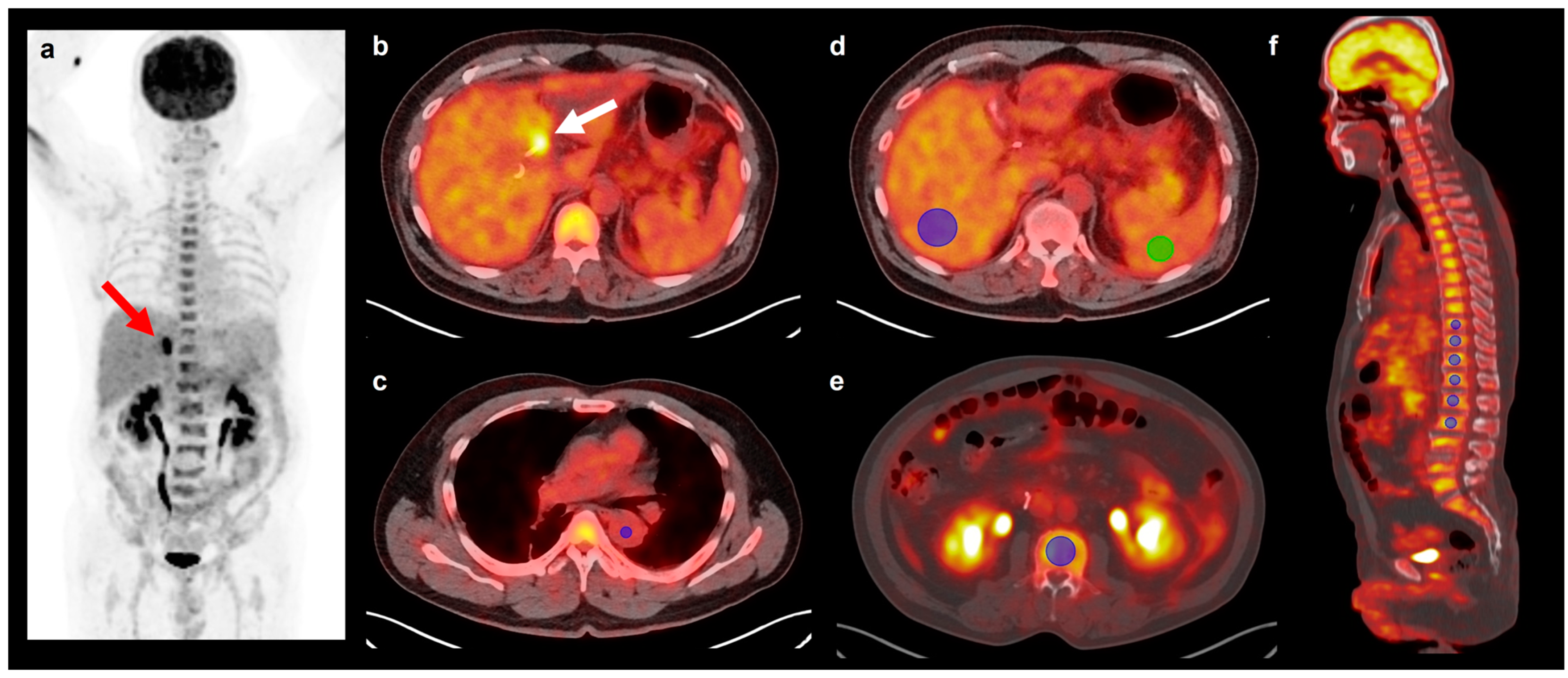 Biomedicines 12 00944 g001 Biomedicines 12 00944 g001